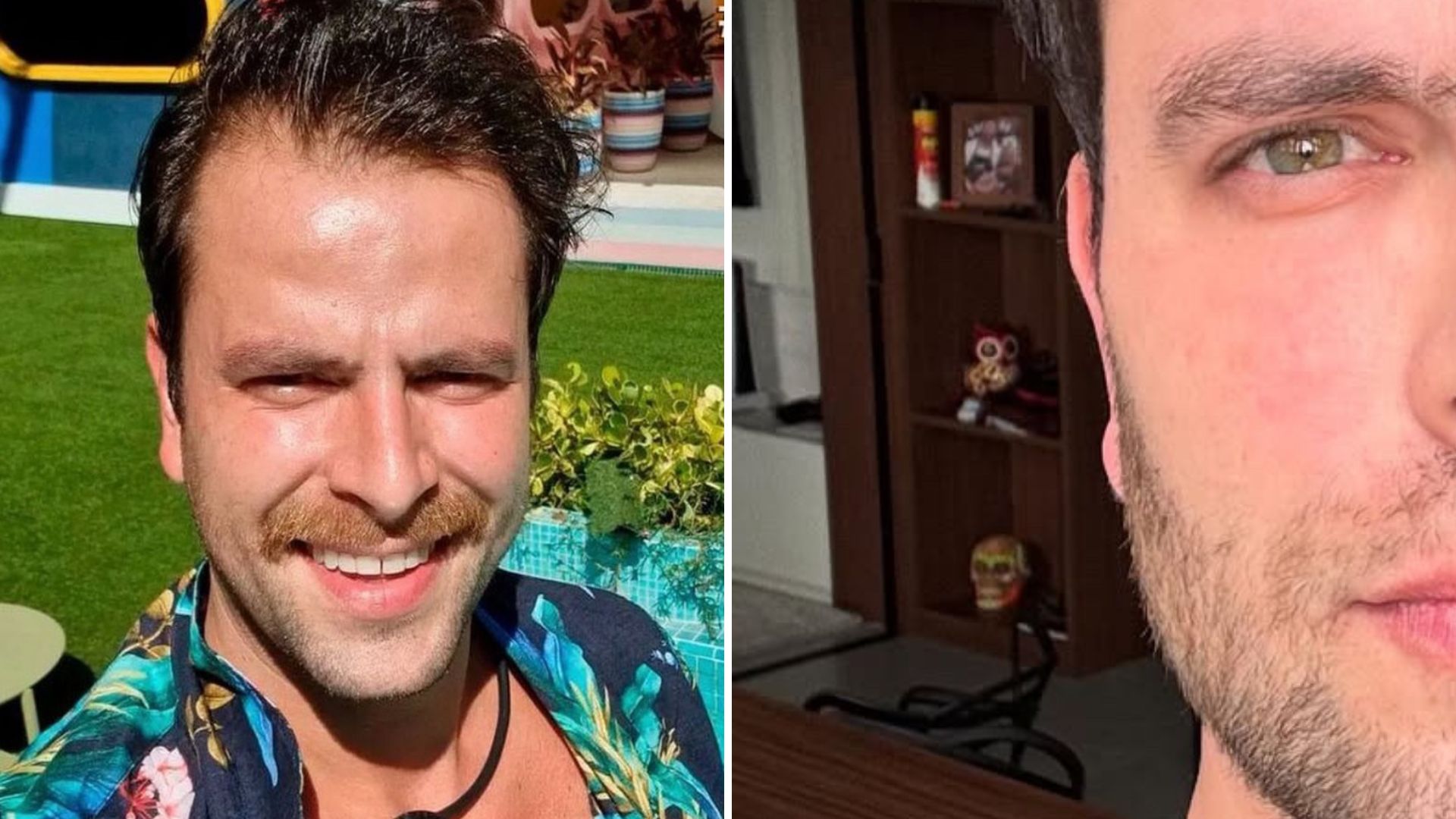 Mudou muito? Ex-BBB Gustavo radicaliza visual após procedimentos estéticos