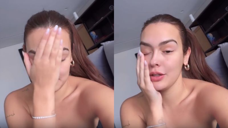 Ex-BBB Larissa leva 14 pontos após acidente delicado: ‘Chegou a dar para ver o osso’