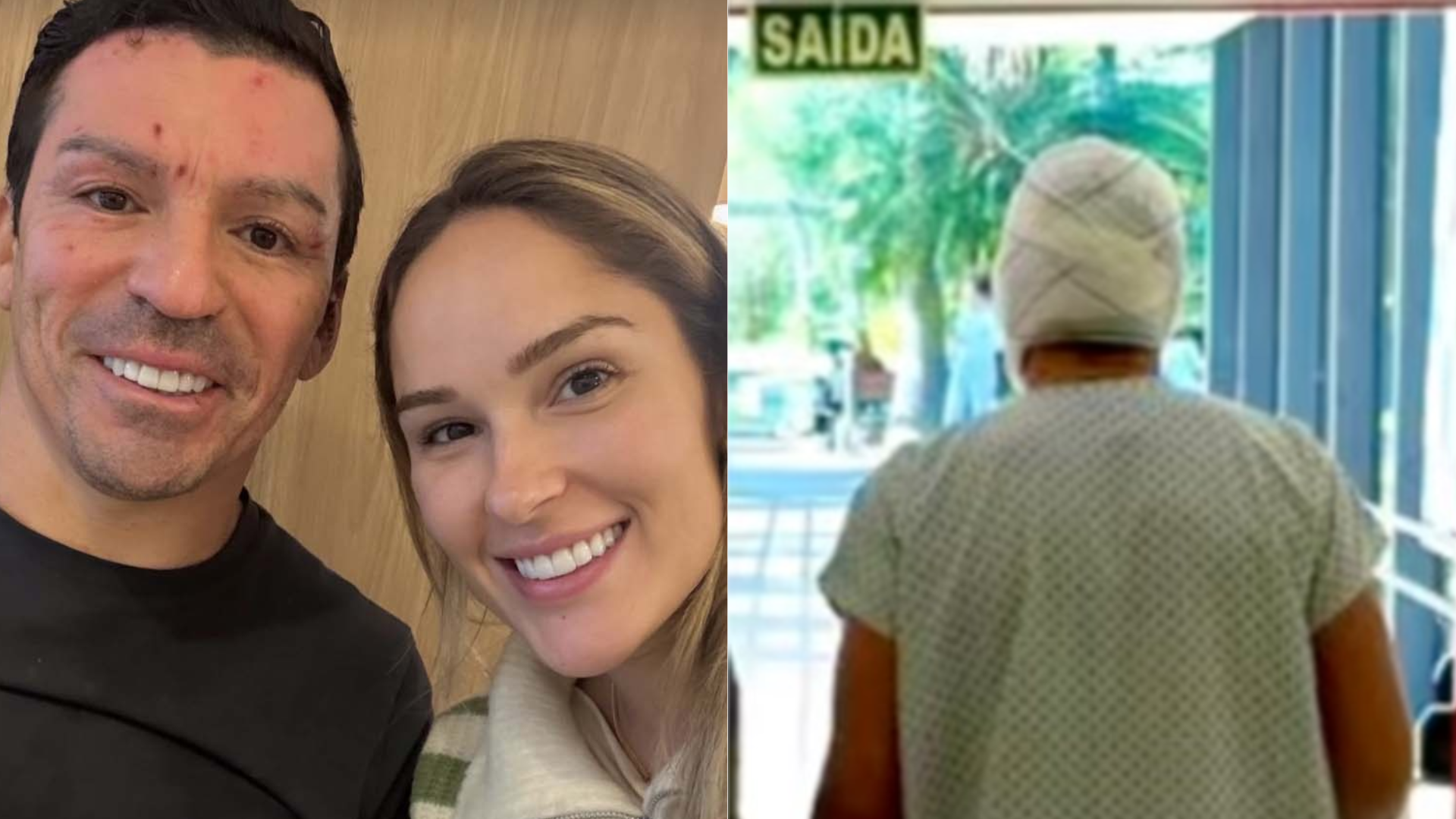 Ex-jogador da seleção mostra o rosto pela primeira vez após sofrer queimaduras em 18% do corpo