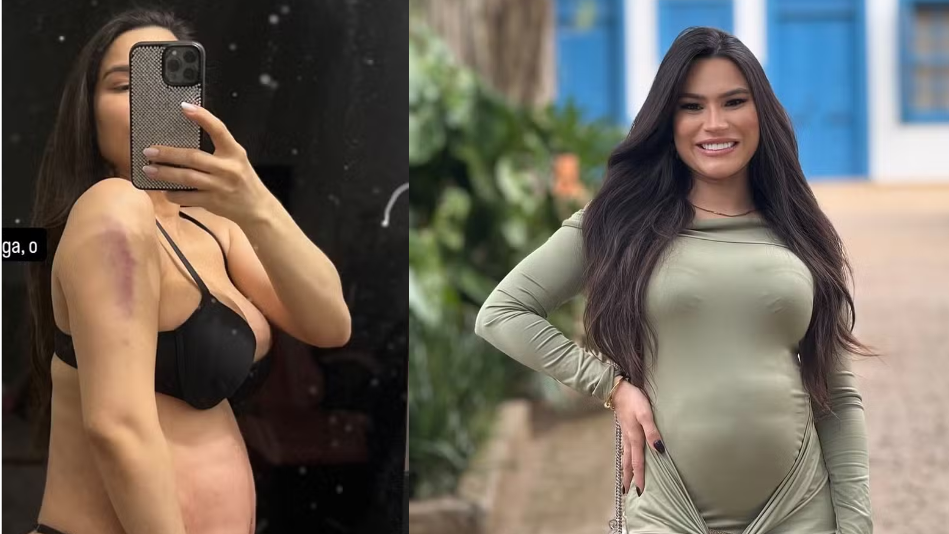 Grávida, ex-fazenda Raissa Barbosa leva tombo e se preocupa: ‘Correndo para o hospital’