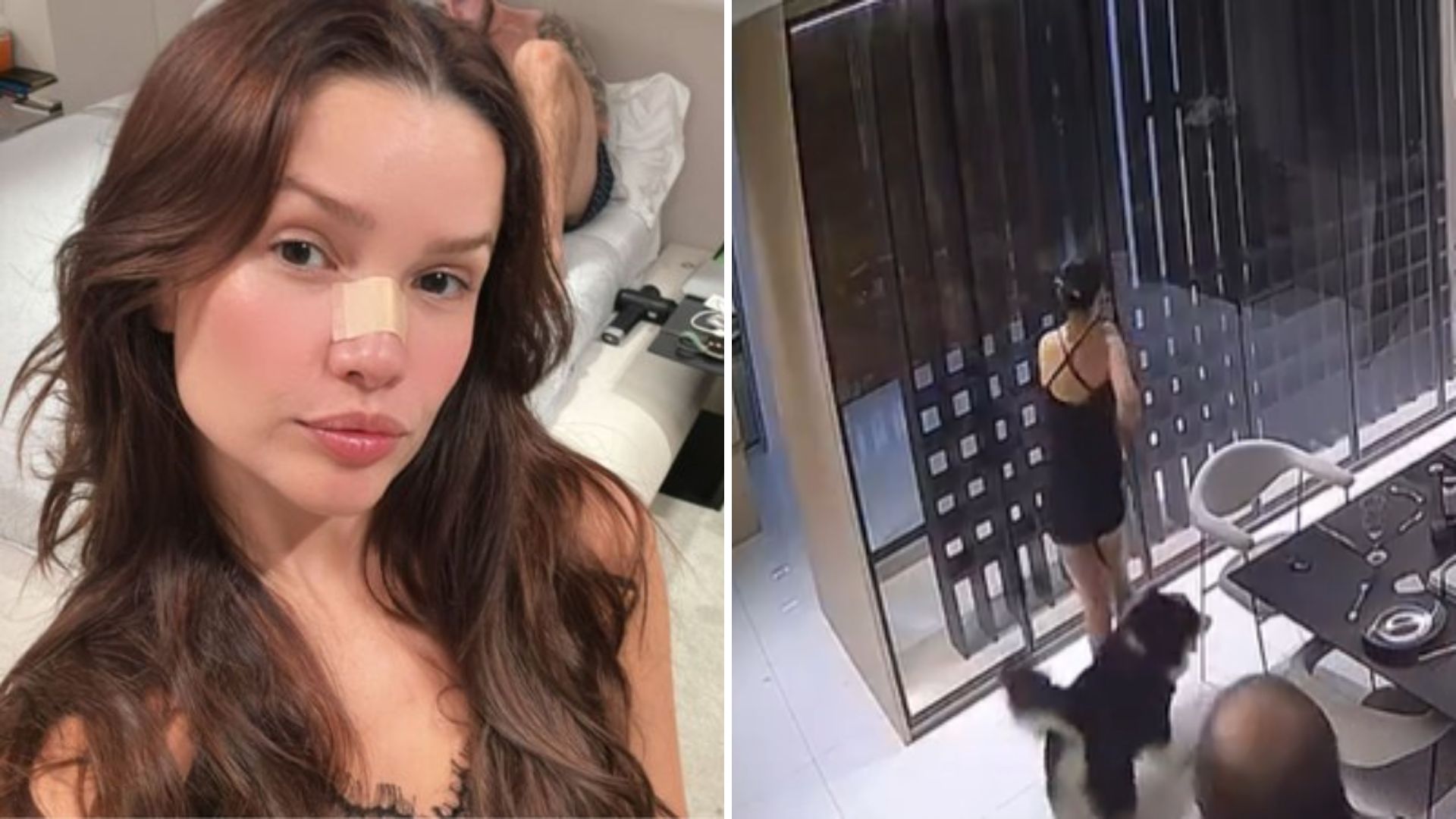 Juliette é empurrada em casa e sofre acidente doméstico: ‘Quase quebrei o resto do nariz’