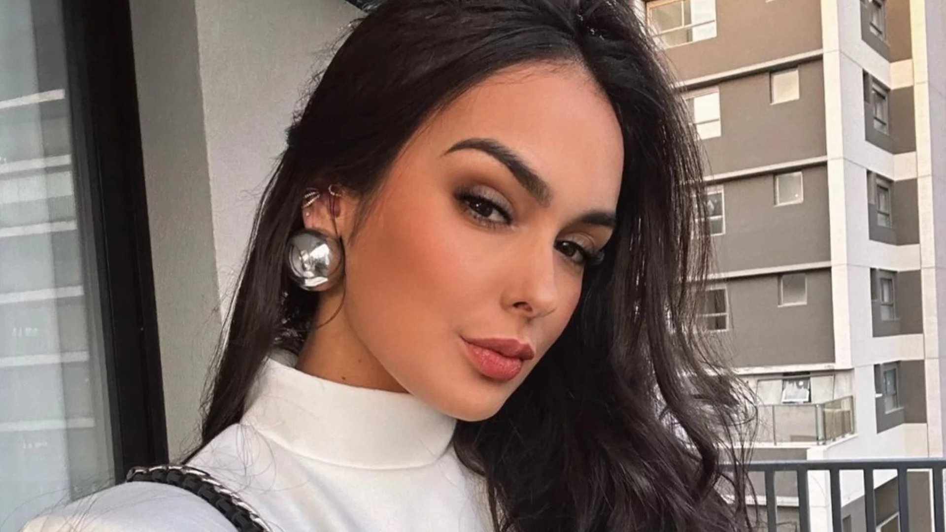 Ex-BBB Larissa Santos detalha sua recuperação após levar 14 pontos em acidente: ‘Evoluindo’