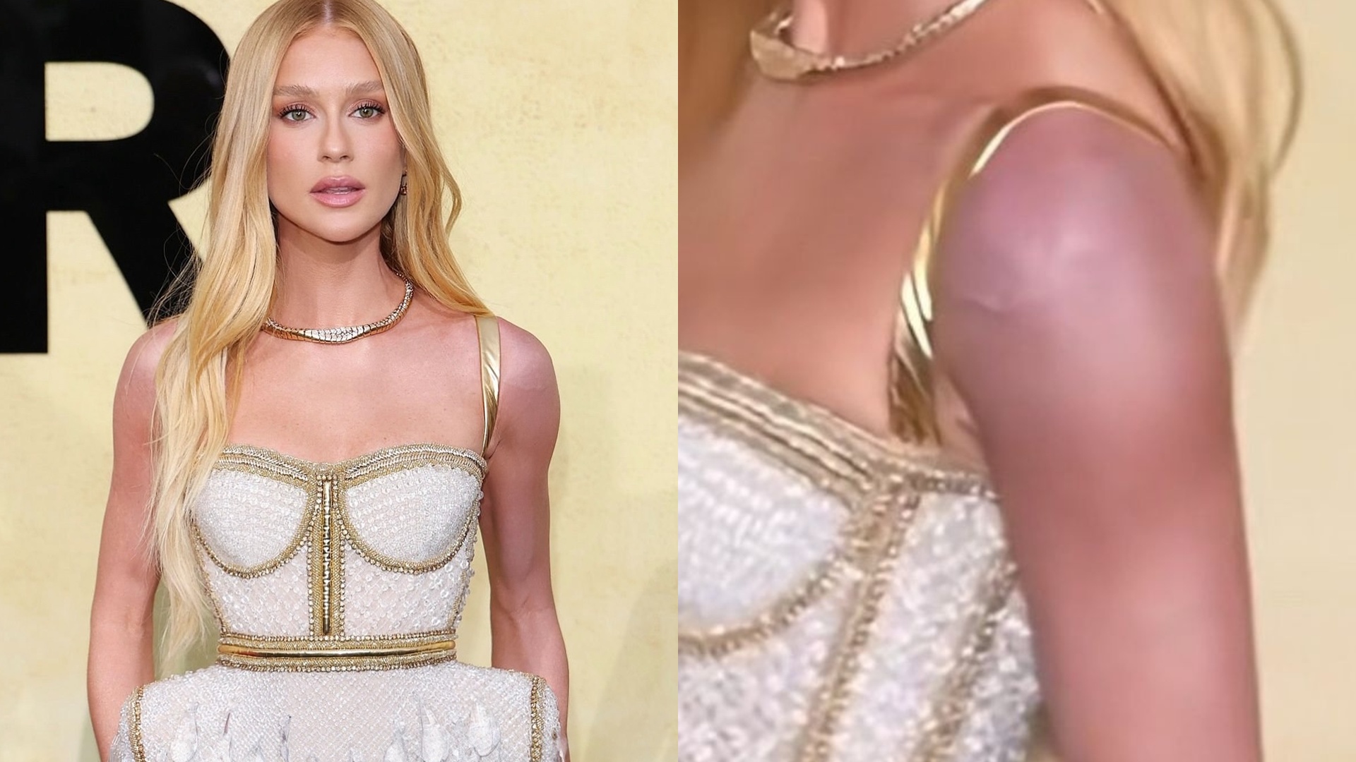 O que rolou? Marina Ruy Barbosa se justifica após aparecer com o braço roxo em evento