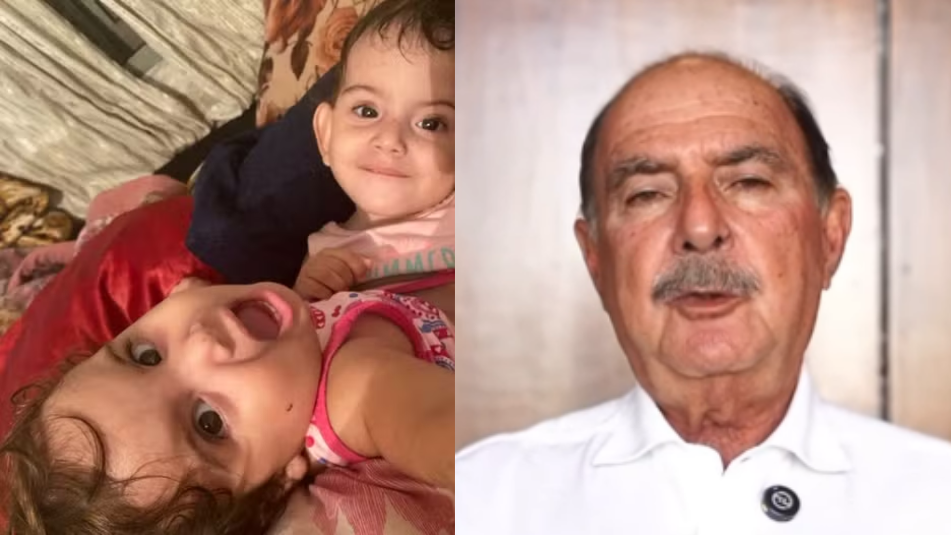 Médico que fez cirurgia de separação lamenta morte de siamesa em Goiás: ‘Doloroso’