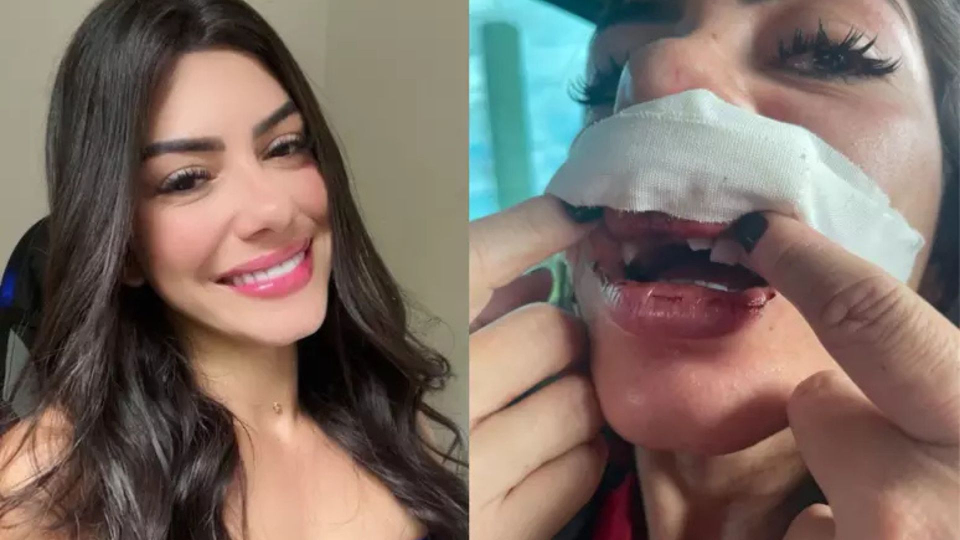 Mulher retira queixa contra cantor após ter dentes quebrados; saiba quem