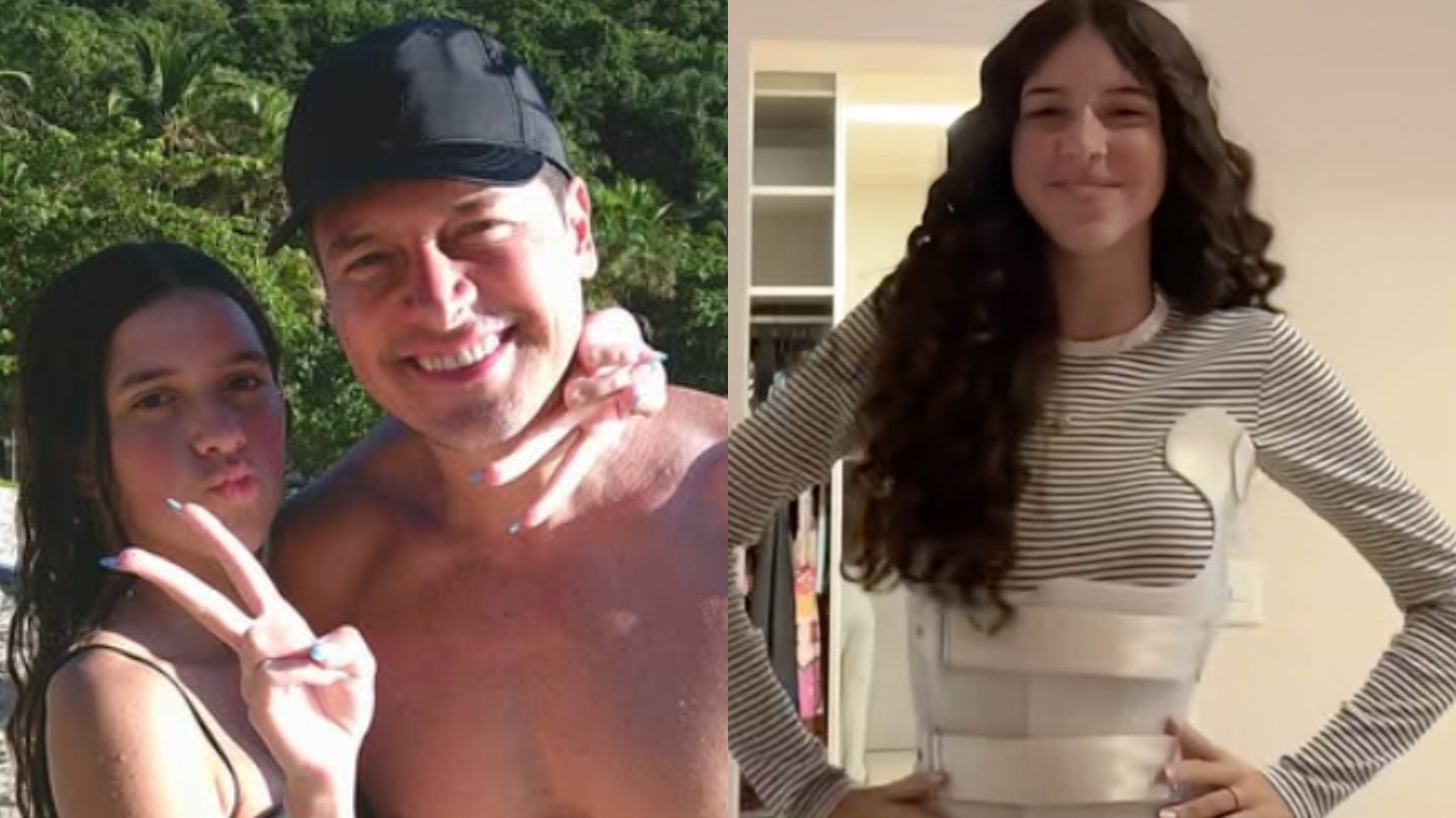 O que é escoliose? Entenda a condição que afeta a filha de 16 anos de Rodrigo Faro
