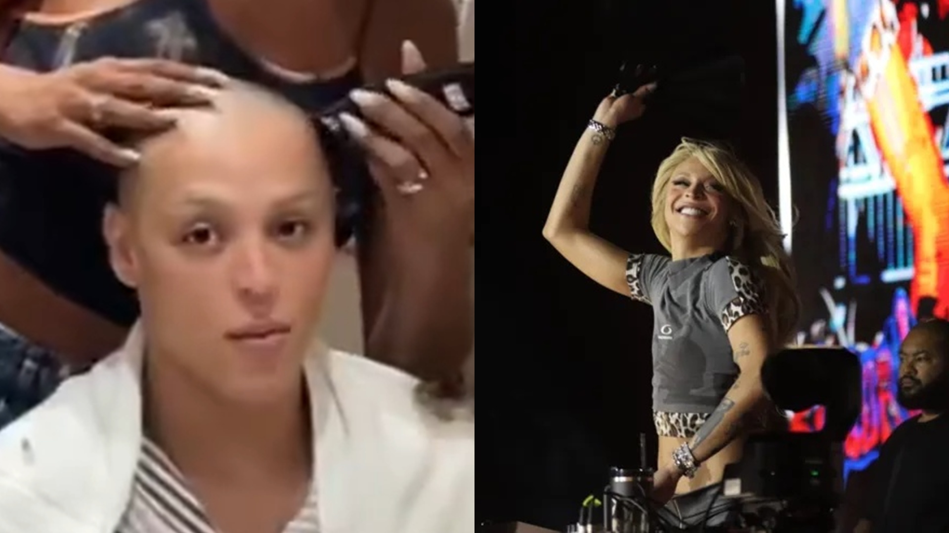 Doente e careca, Pabllo Vittar rebate ataques por abrir show de Lady Gaga: ‘Essa bicha’