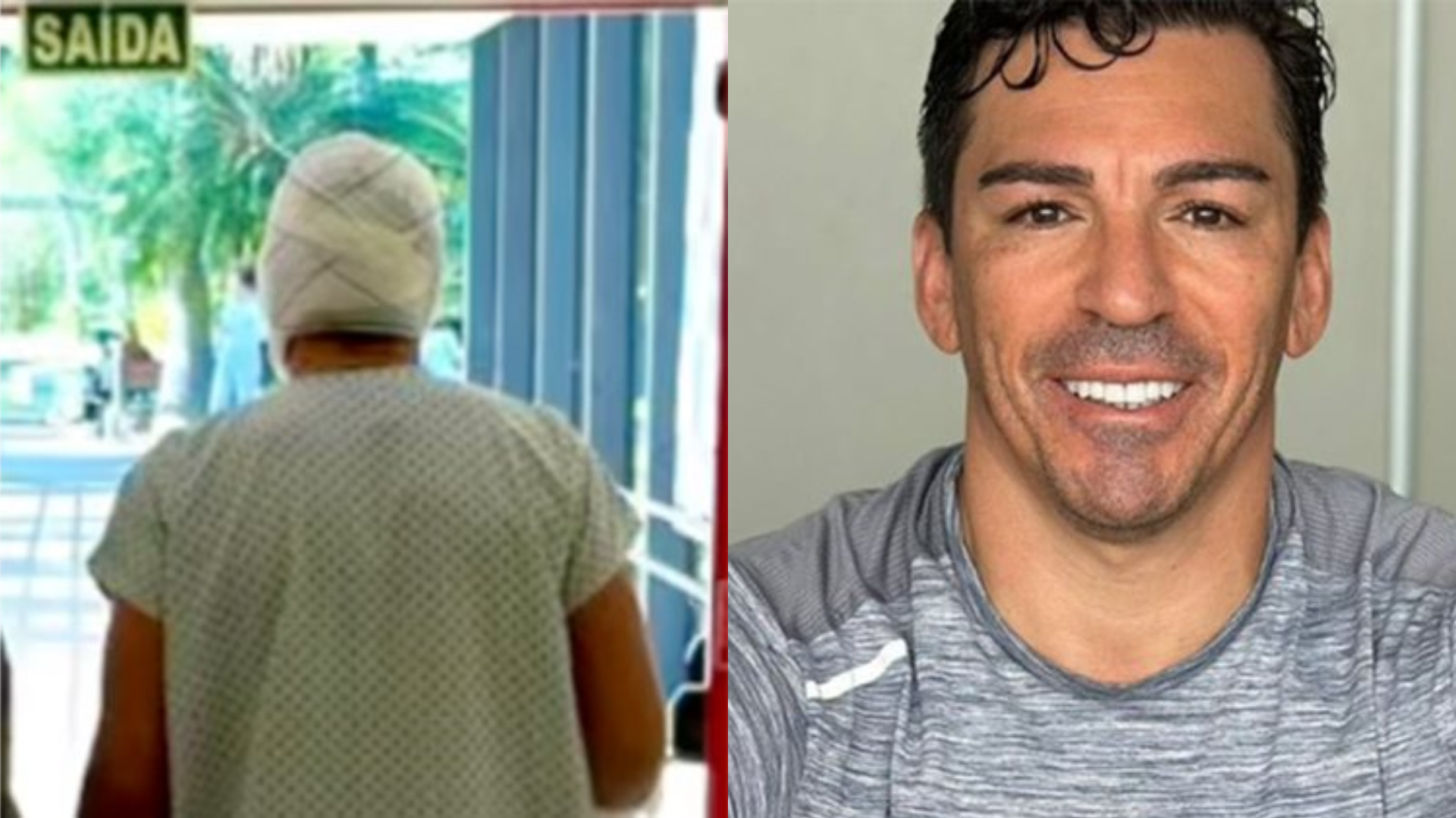 Que tragédia! Ex-jogador da seleção teve 18% do corpo queimado após acidente doméstico