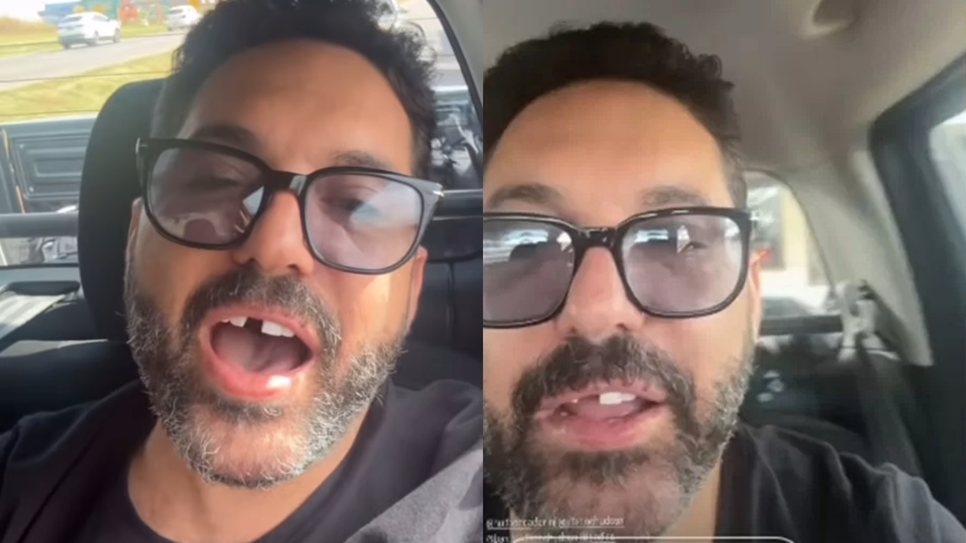 Dupla com Hudson, sertanejo Edson faz apelo após perder dente antes de show: ‘Me ajuda’