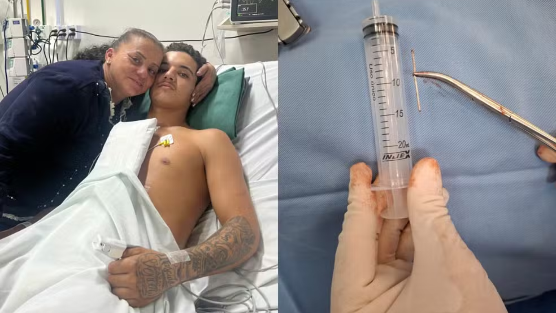 IMPRESSIONANTE! Adolescente dispara pistola de pregos no próprio coração sem querer