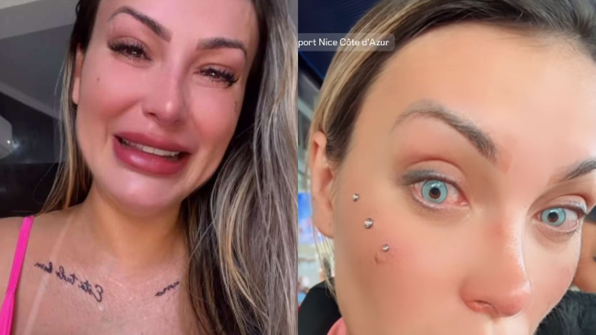 Andressa Urach se manifesta sobre situação drástica dos olhos: ‘Buscar ajuda’
