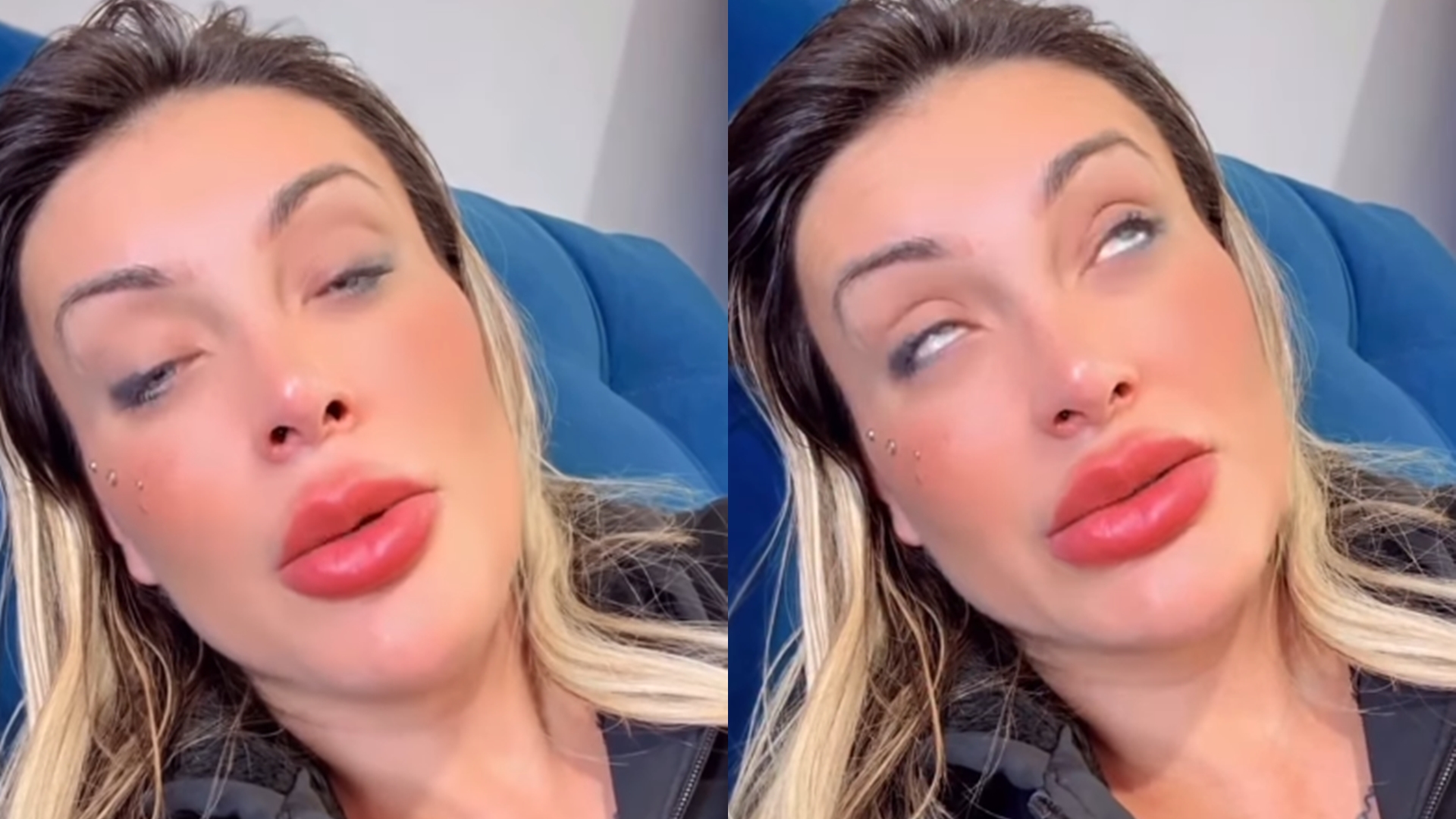 Andressa Urach desespera os fãs ao aparecer abatida após cirurgia nos olhos: ‘Medo de ficar cega’