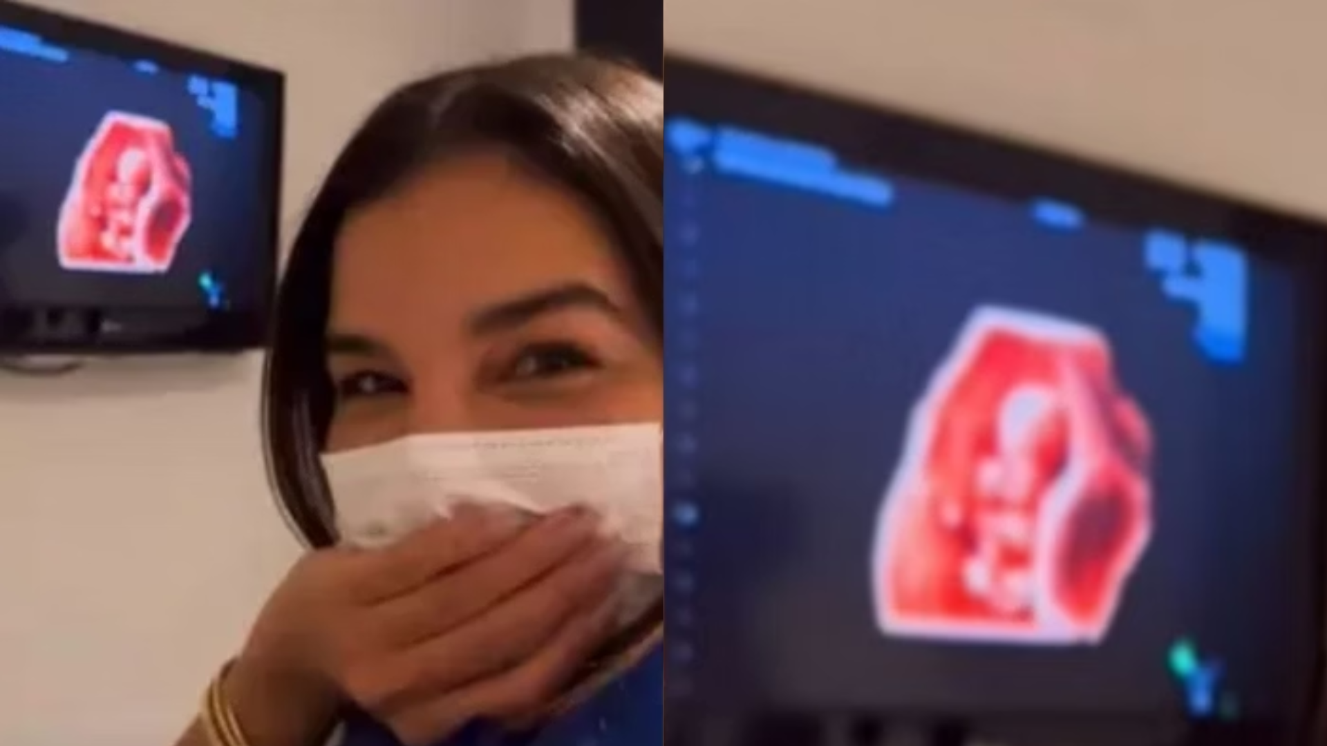 Após 5 anos tentando engravidar, Mariana Rios mostra ultrassom e emociona fãs: ‘Sinto”