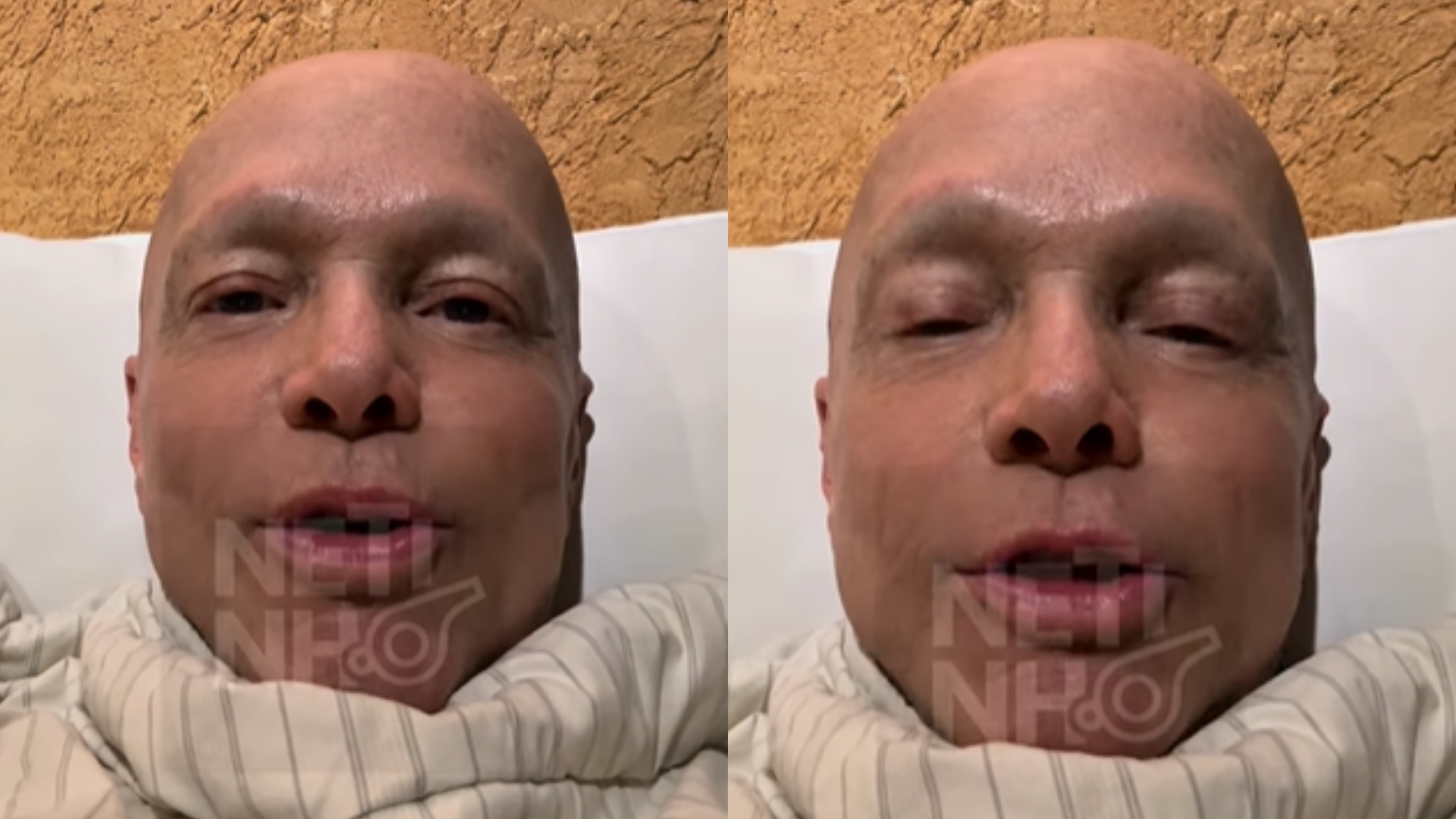 Após quimioterapia, cantor Netinho surge abatido e revela desejo: ‘Vontade imensa’