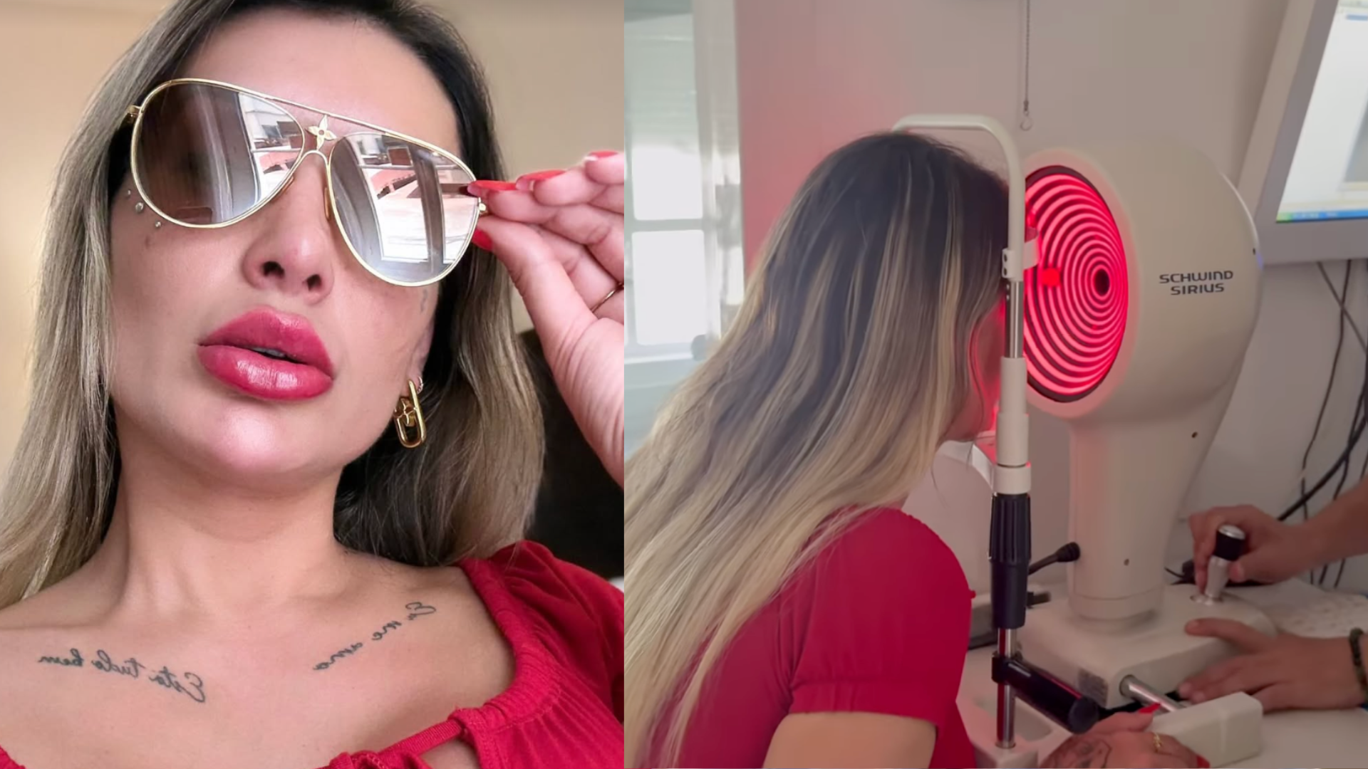 Mudou os olhos! Web reage a novo procedimento de Andressa Urach: ‘Pena’