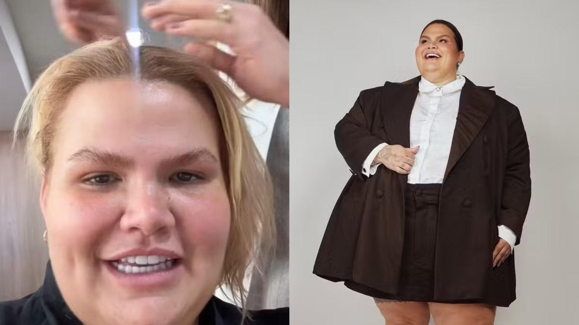 Influenciadora perde muito cabelo após cirurgia bariátrica: ‘Se agravou no pré-cirúrgico’