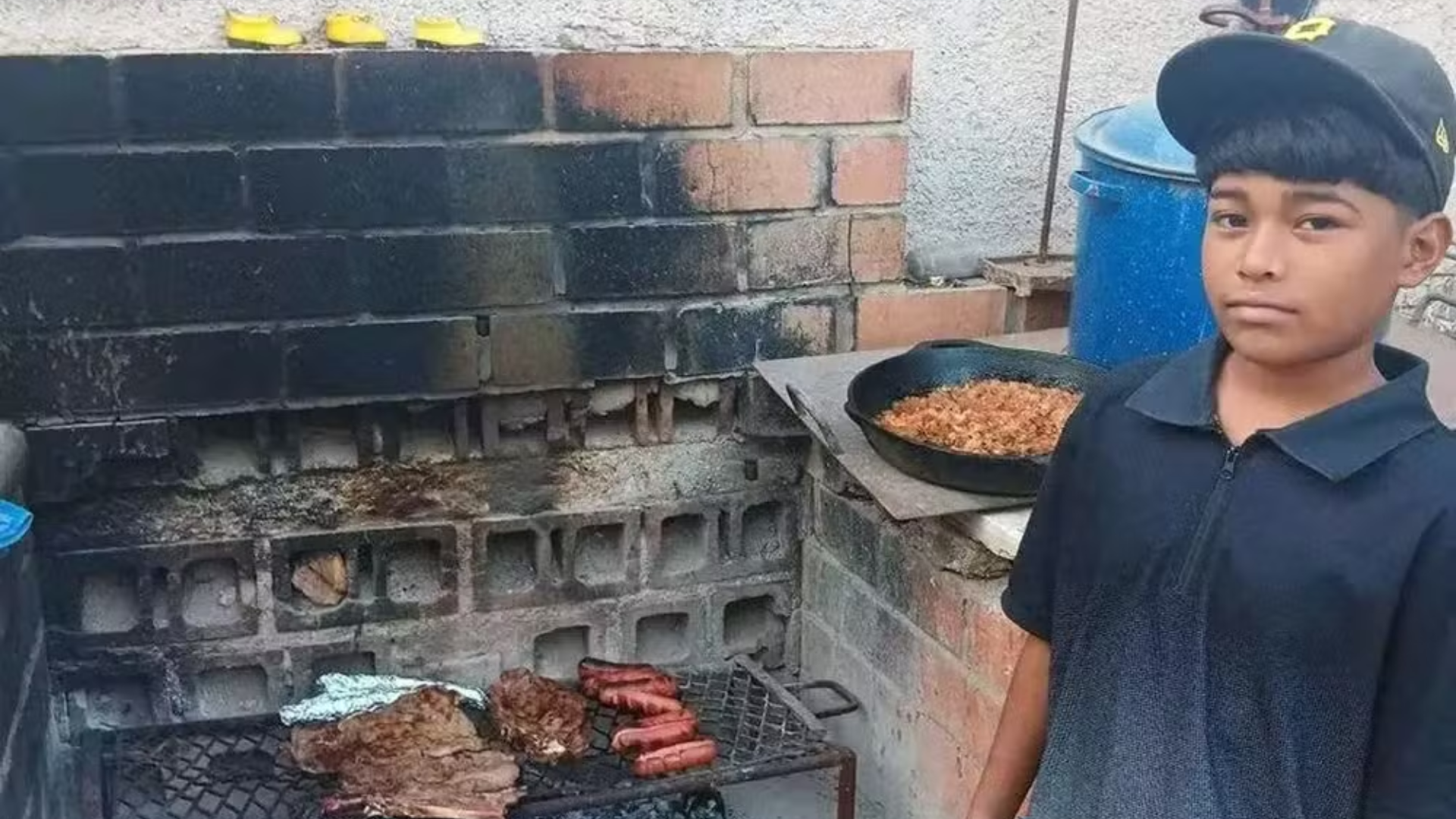 Menino de 12 anos morre após infecção grave causada por piolhos