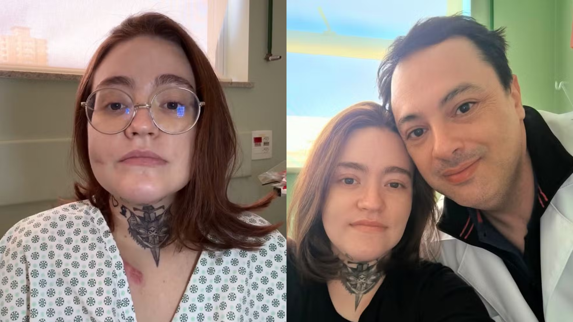 Mulher vai ser colocada em coma induzido para tentar reverter ‘pior dor do mundo’