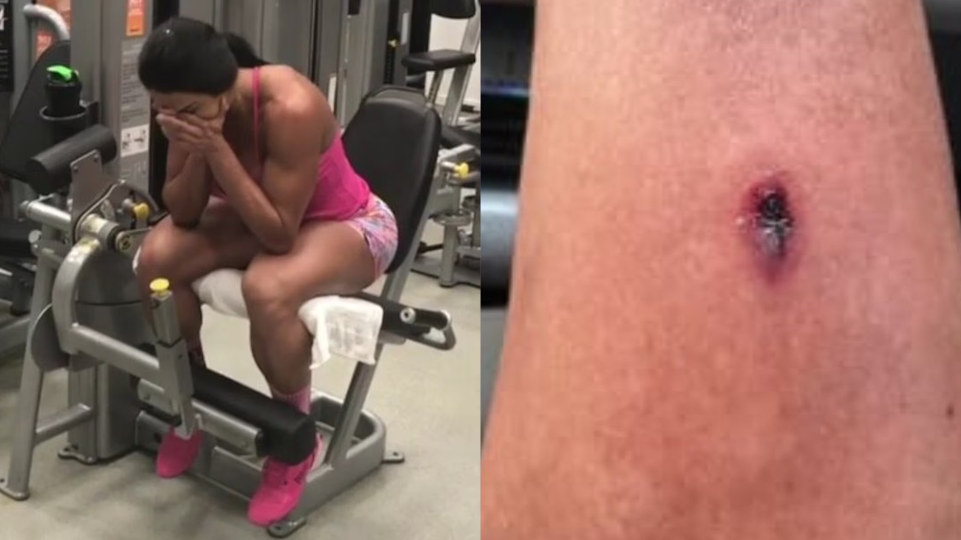 Perigo! Gracyanne Barbosa sofre acidente na academia e desabafa: ‘Escorregou’