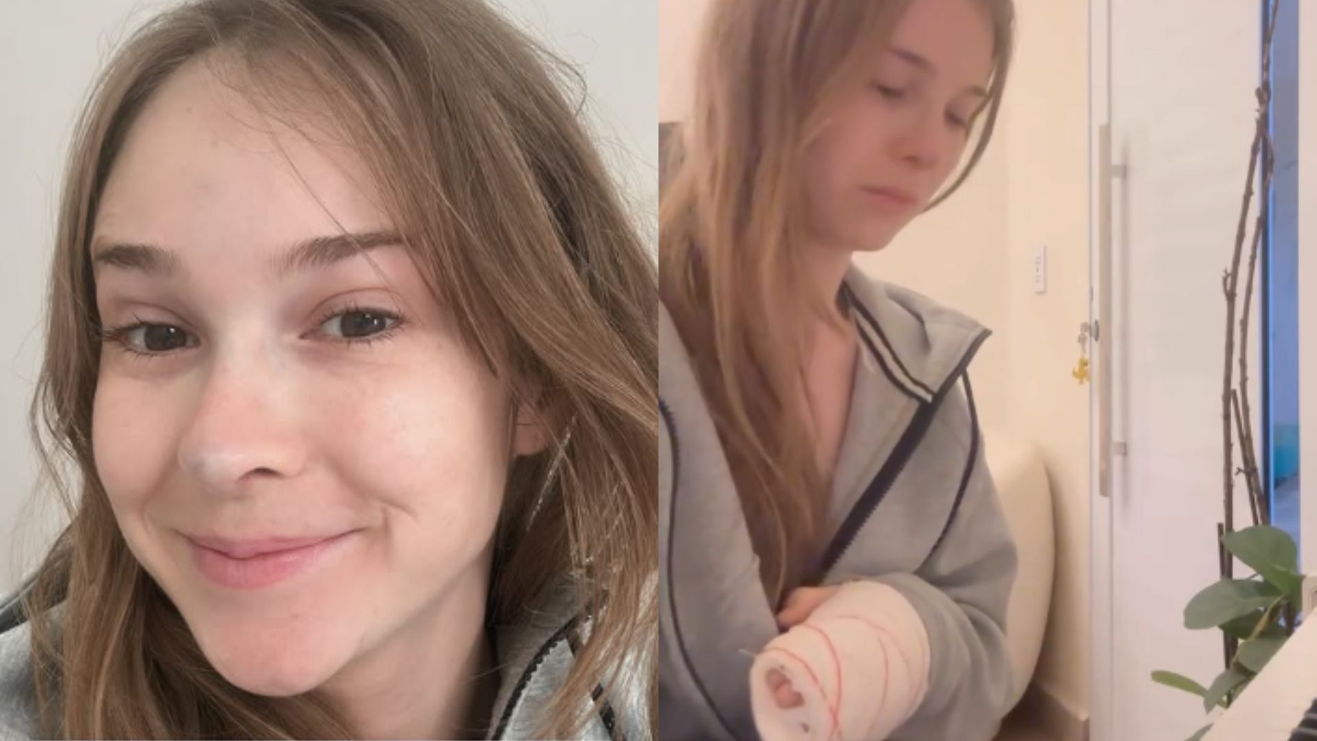 Ex de Pyong, Sammy choca ao revelar quanto gastará em cirurgia; veja