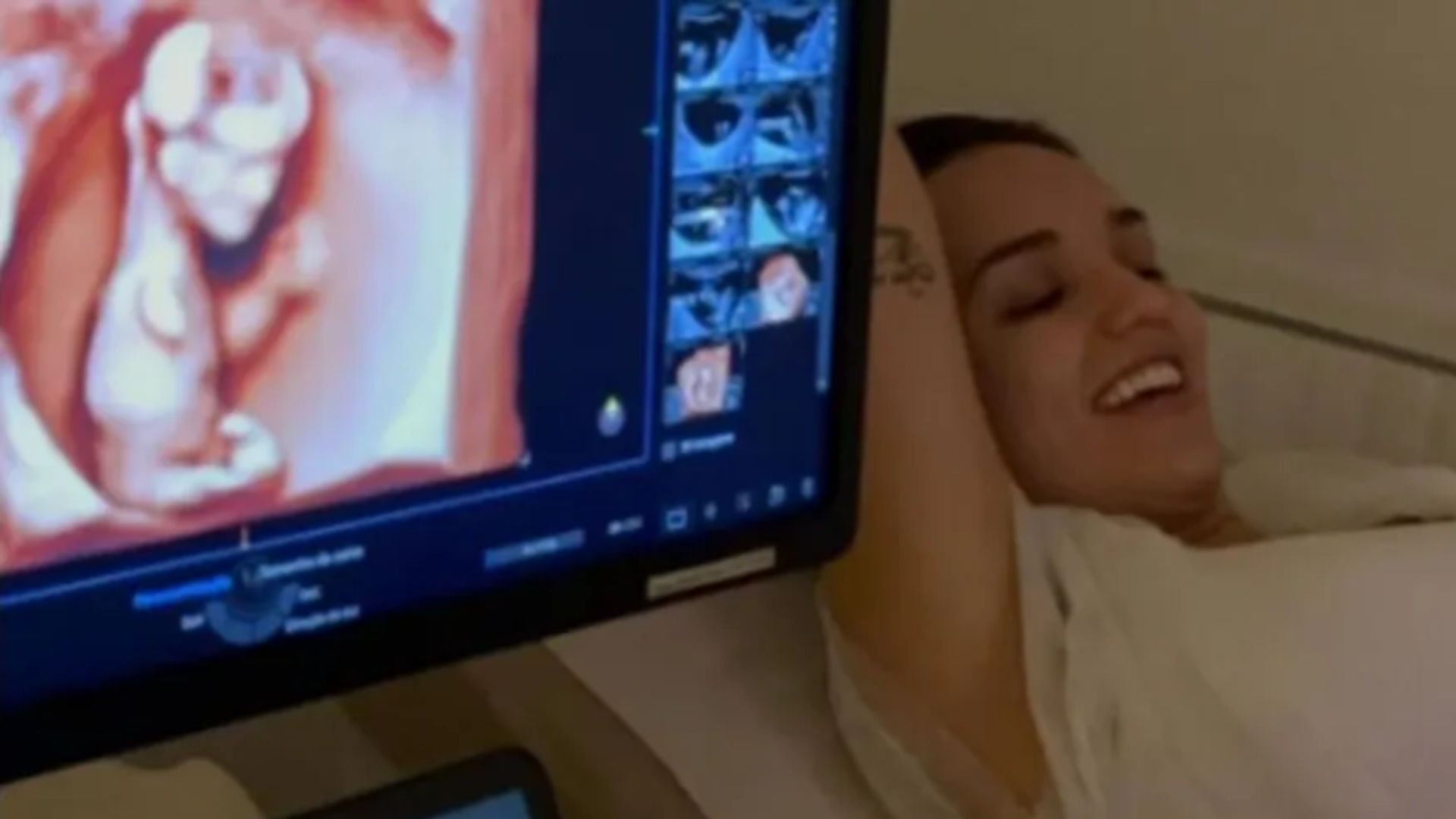 Após perda dolorosa, Rafa Kalimann emociona web ao mostrar ultrassom da filha: ‘Não acho justo’