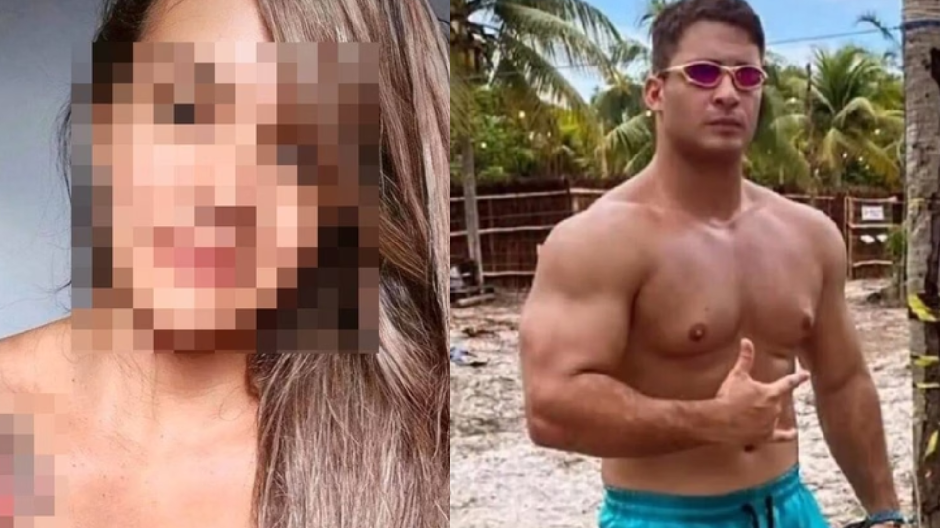 Mulher de 35 anos é espancada por ex-jogador de basquete e tem rosto desfigurado