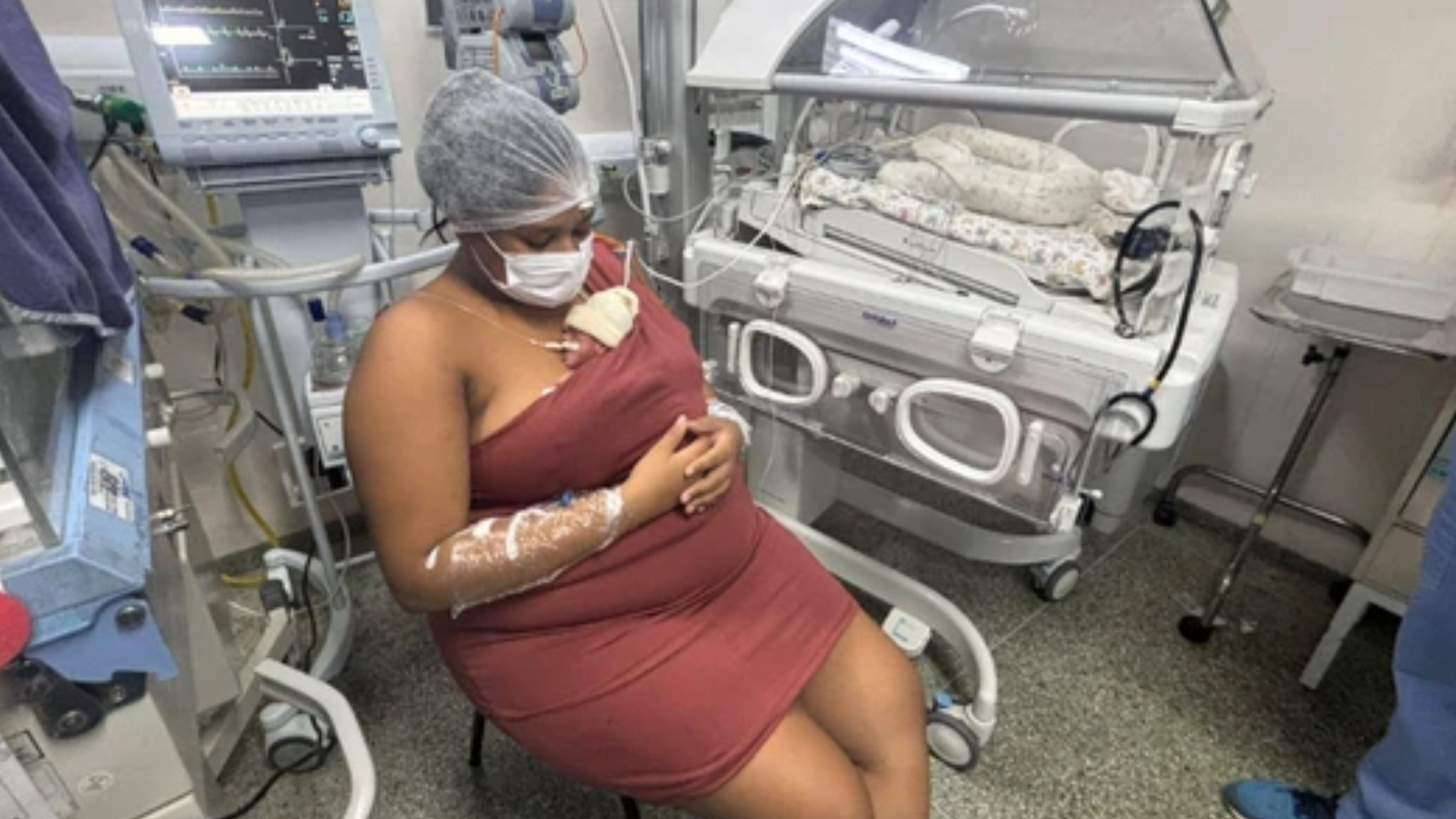 Mulher de 23 anos surpreende ao dar à luz quadrigêmeos na Bahia