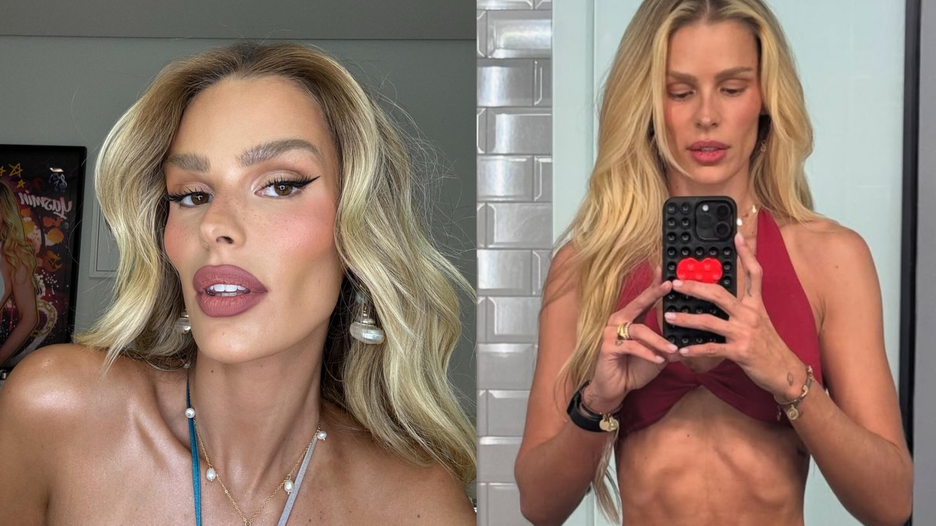 Yasmin Brunet abre o coração e desabafa após perder 20kg: ‘Doença crônica’