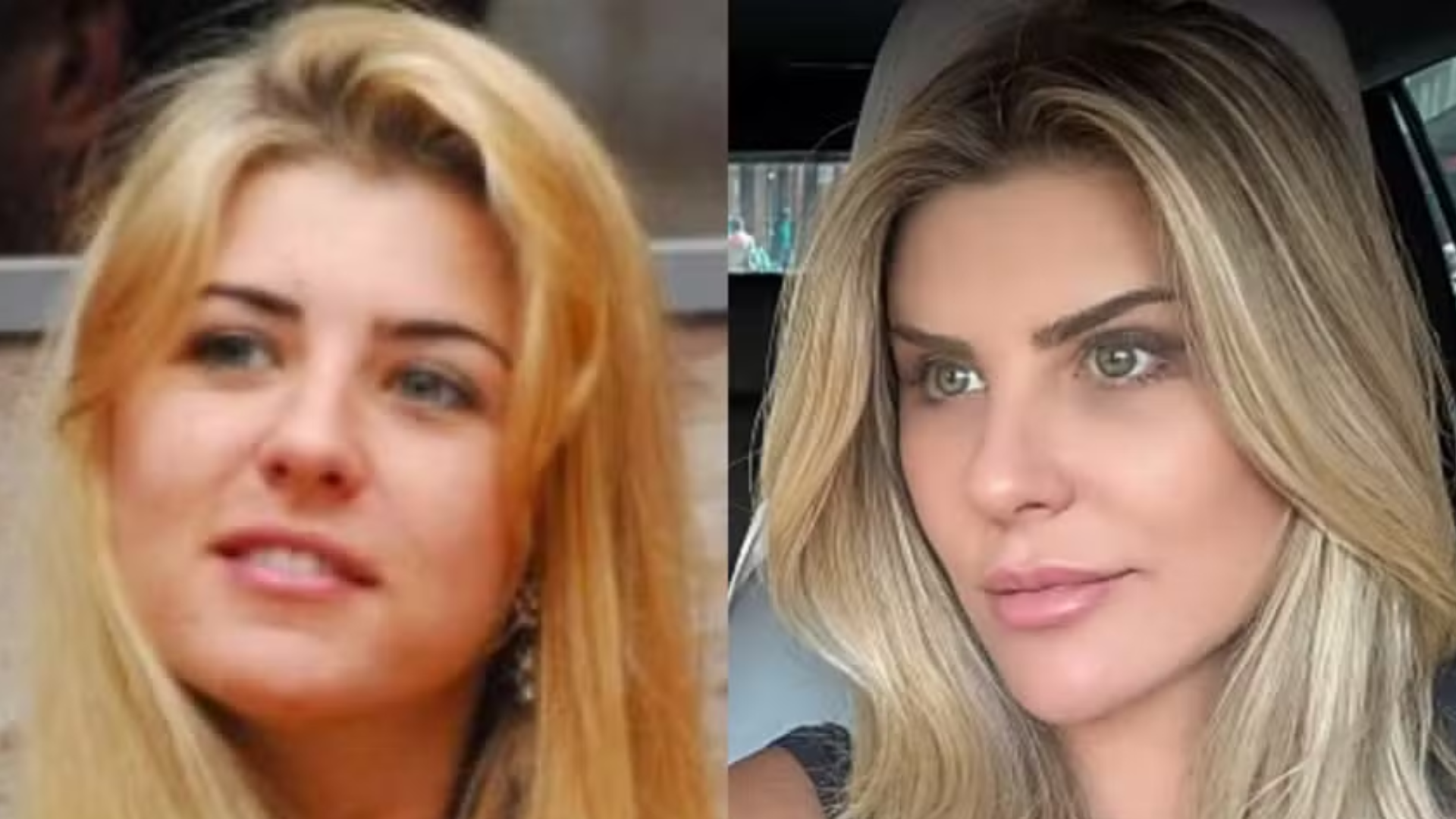 Ex-BBB Íris Stefanelli revela transformação após cirurgias: ‘Maiores investimentos’
