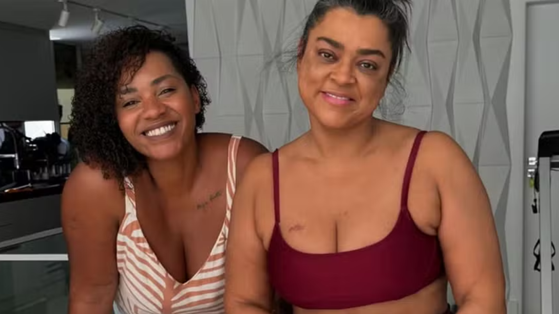 Fisioterapeuta de Preta Gil relembra o sofrimento da cantora: ‘Dores mais dificeis’