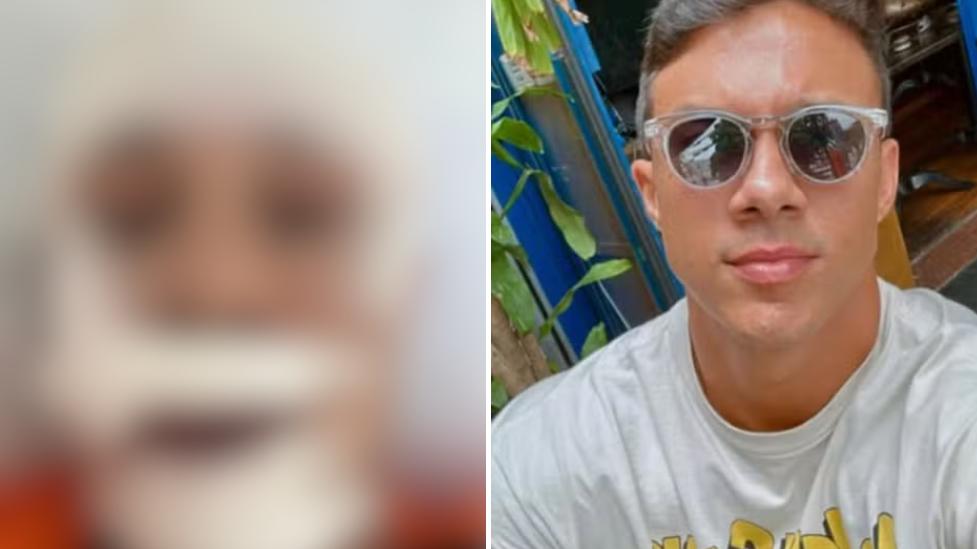 Homem leva 45 pontos no rosto após defender mulheres de assédio