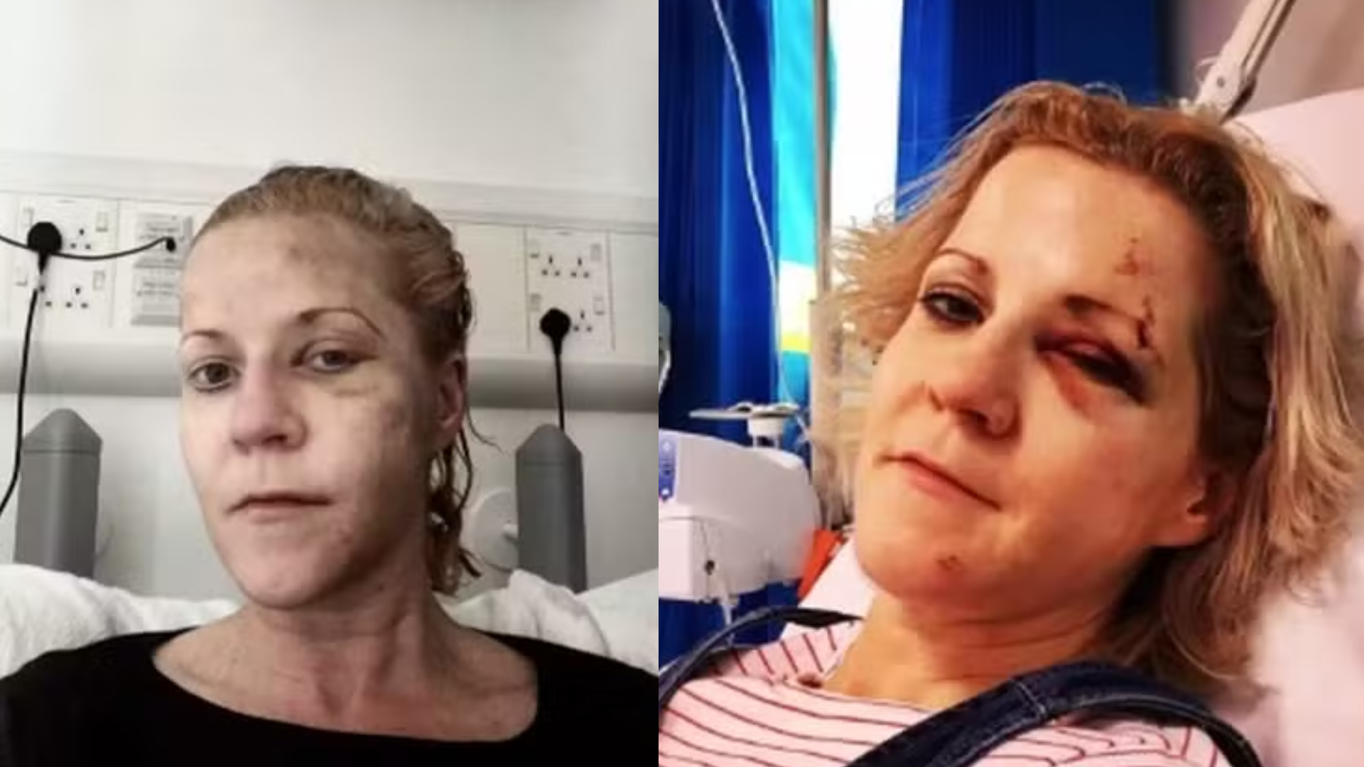 Mulher escapa da morte sete vezes e revela: ‘Não tenho mais medo de nada’