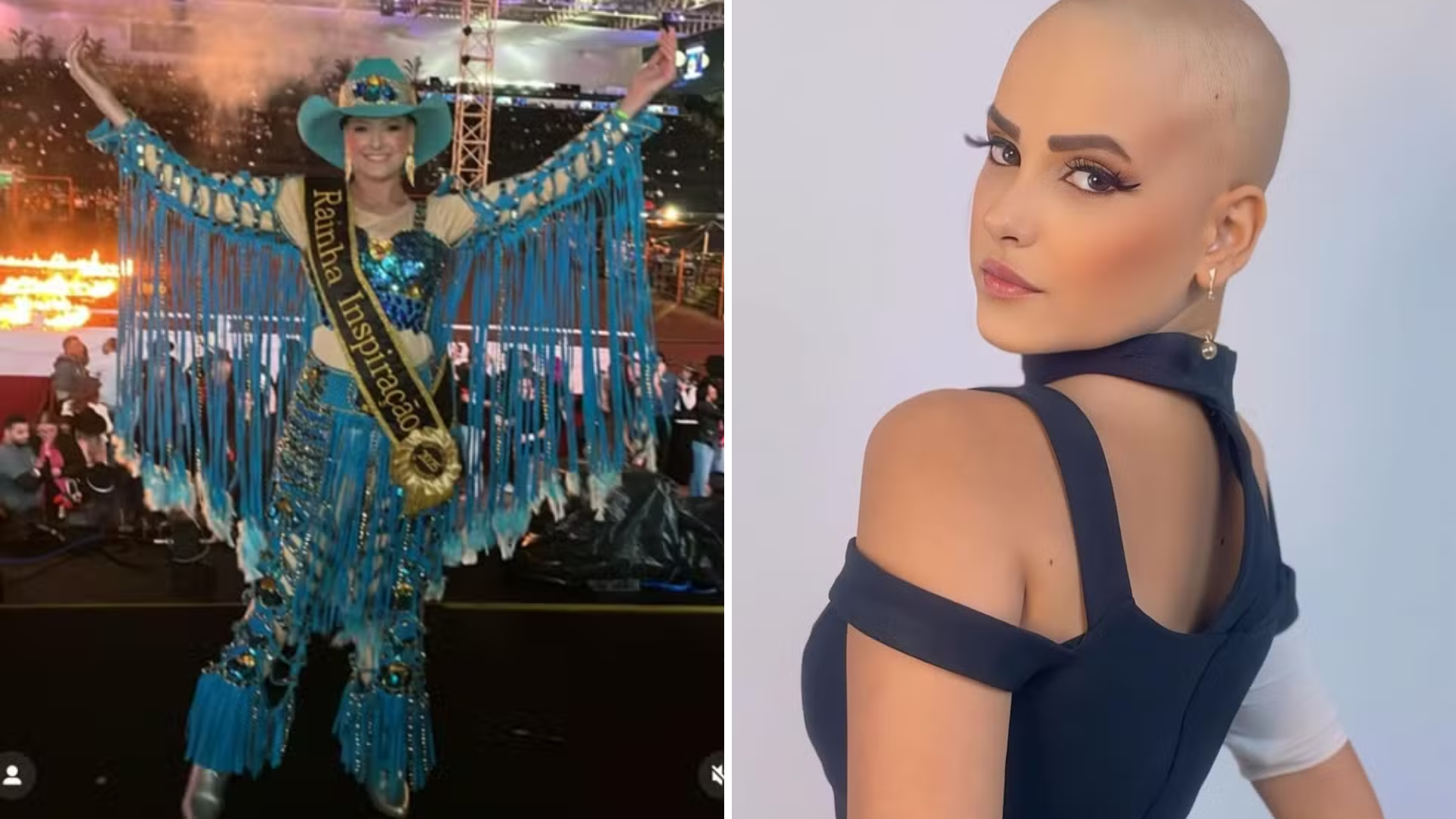 Morre Rainha de Rodeio vítima de câncer descobriu doença ao receber bolada na perna