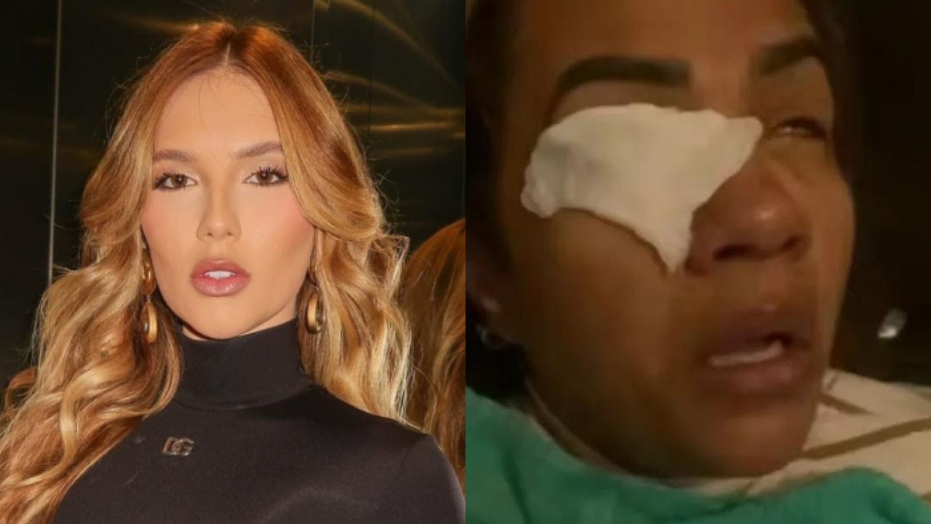 GRAVE! Mulher afirma que ficou cega após usar produto de Virginia Fonseca