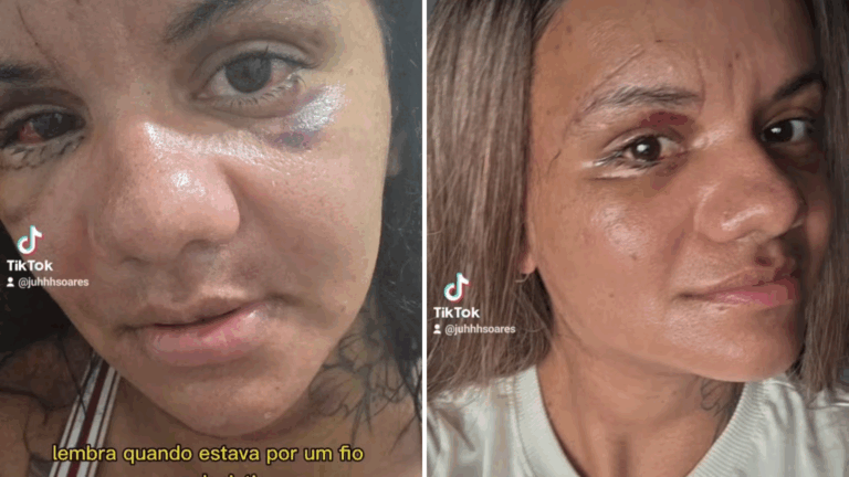 Juliana Soares, agredida com 61 socos, mostra rosto após um mês de cirurgia de reconstrução