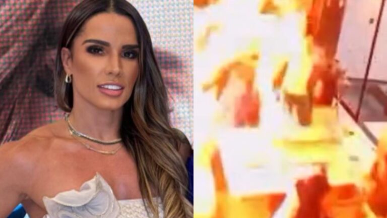 Incêndio! Influenciadora revela detalhes do acidente doméstico grave