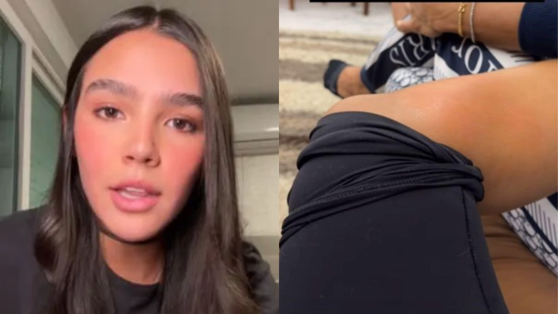 Com tumor no joelho, ex-nora de Angélica revela ter recusado cirurgia: ‘Um risco’