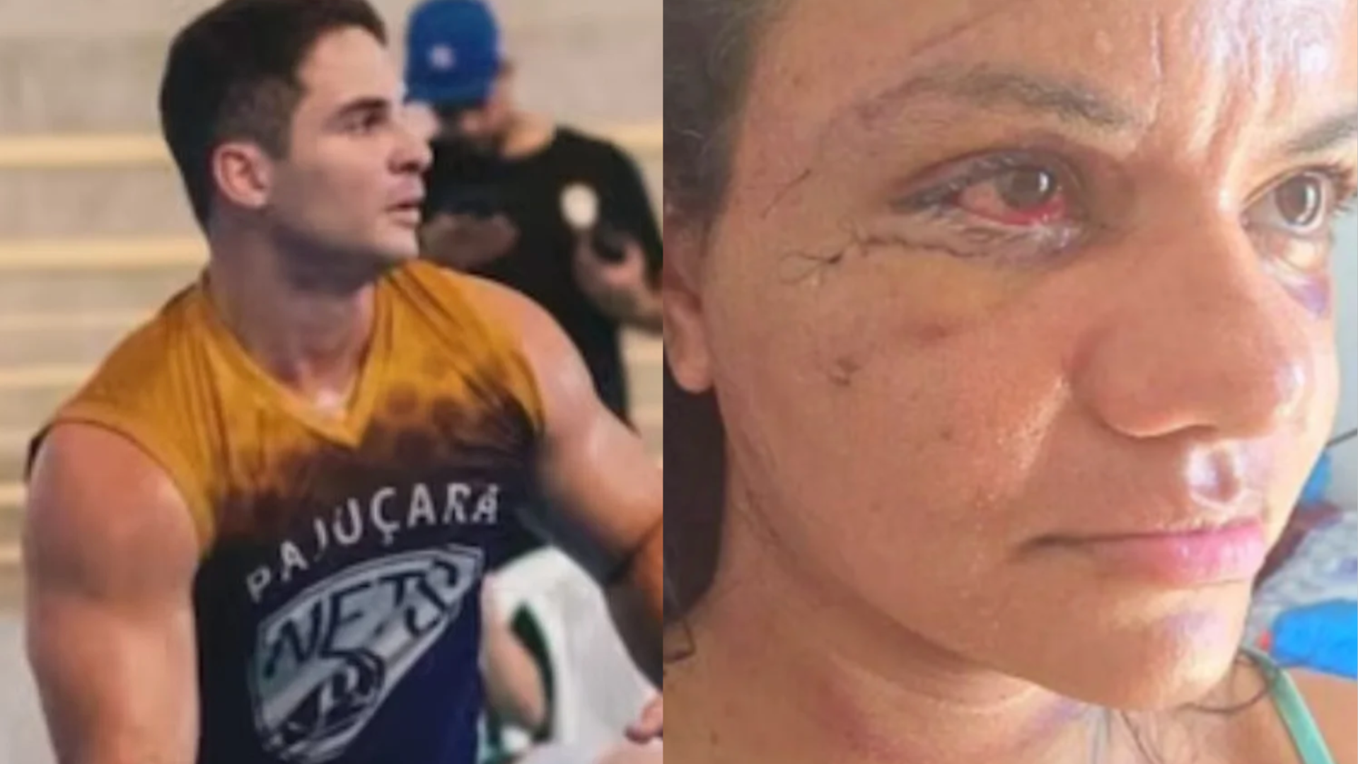 Advogada detalhou os aspectos legais do caso do homem que deu 60 socos na namorada