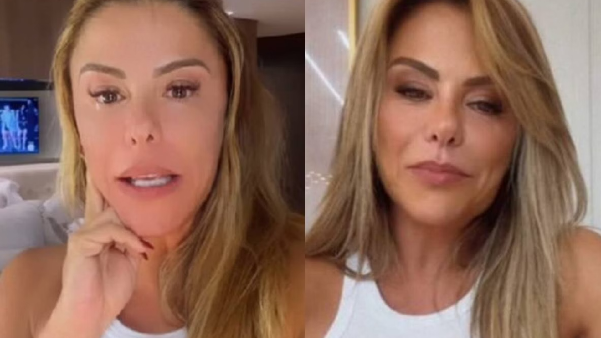 Esposa de Leonardo aparece com olho inchado e revela o diagnóstico; veja detalhes