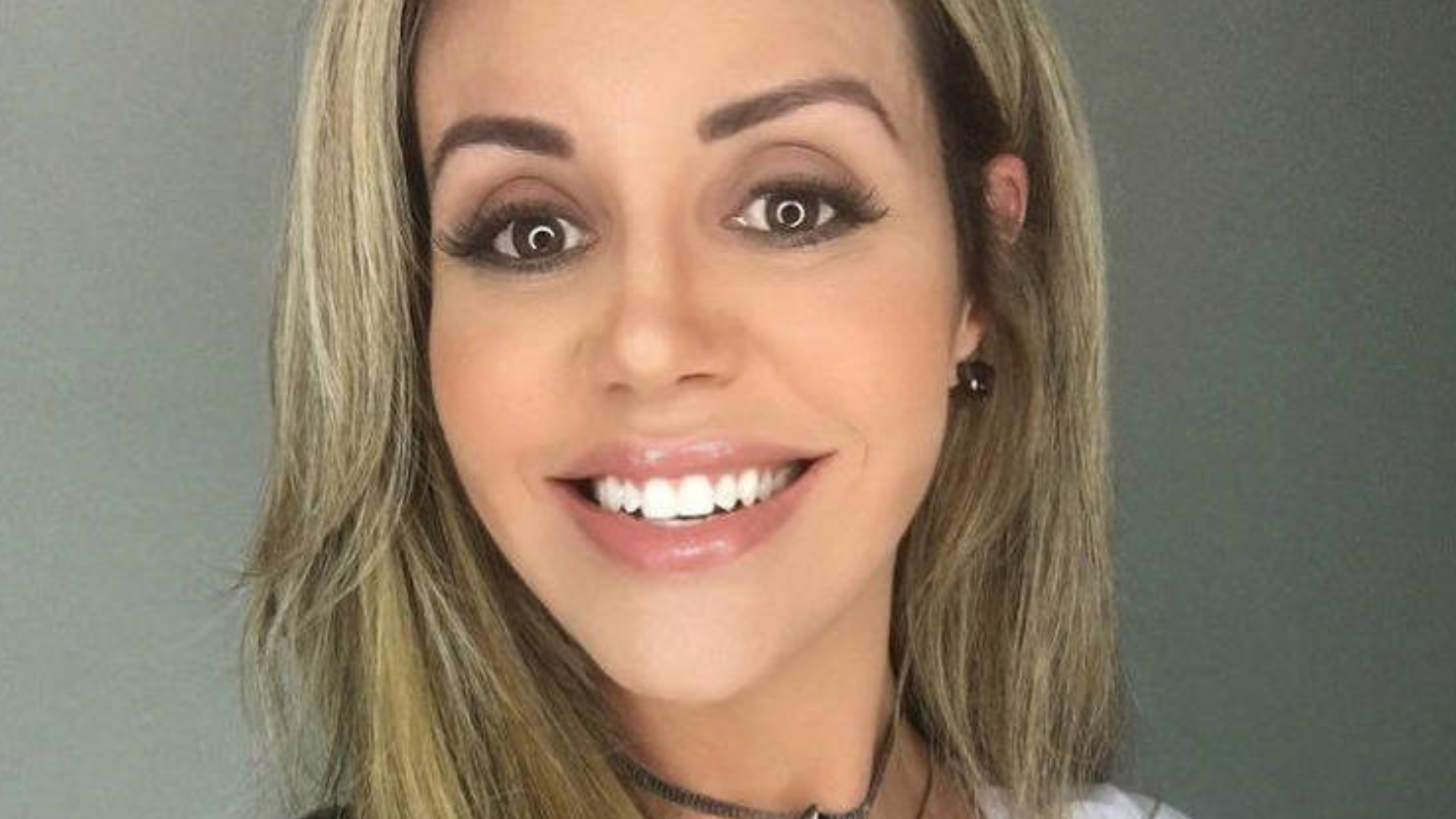 Ex-musa da ‘Banheira do Gugu’ revela diagnóstico de doença inflamatória e diz: ‘Tenho vergonha’
