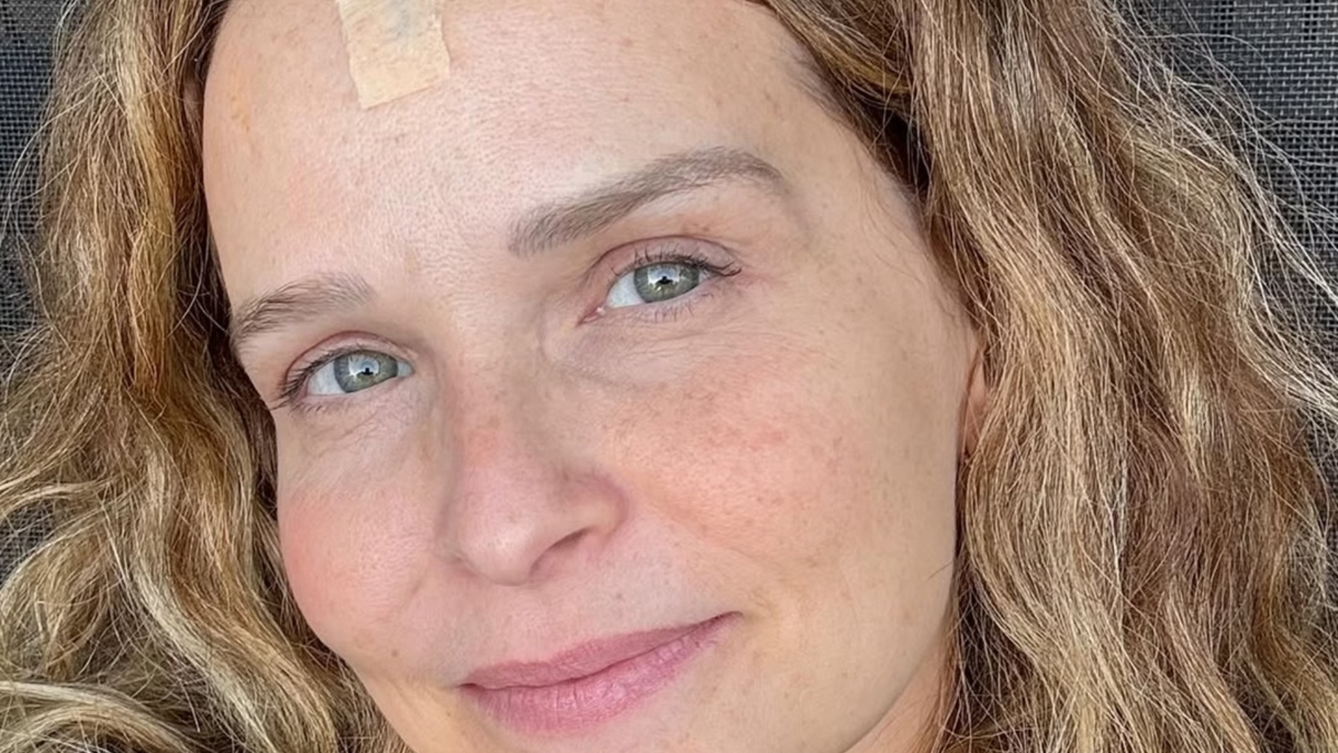 Atriz da Globo é diagnosticada com câncer de pele e faz alerta: ‘Essa manchinha…’