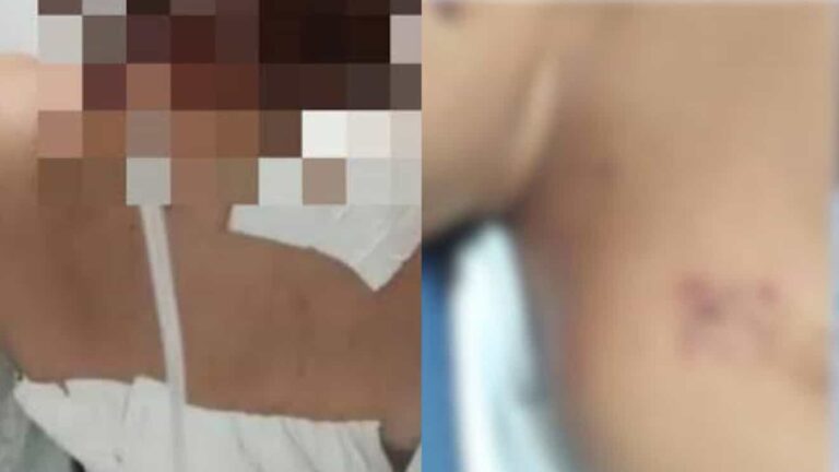 Adolescente grávida é atacada com chave de fenda pelo namorado de 40 anos; veja imagens