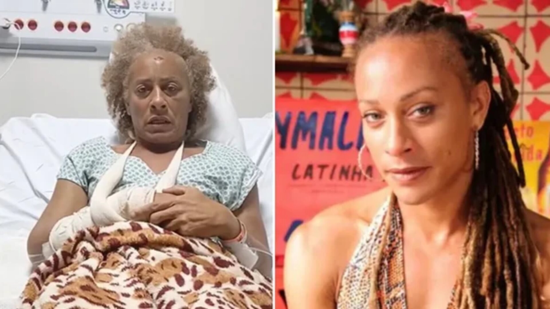 Atriz de ‘Ó Pai Ó’ quebra silêncio após ser agredida a pauladas pelo ex-namorado