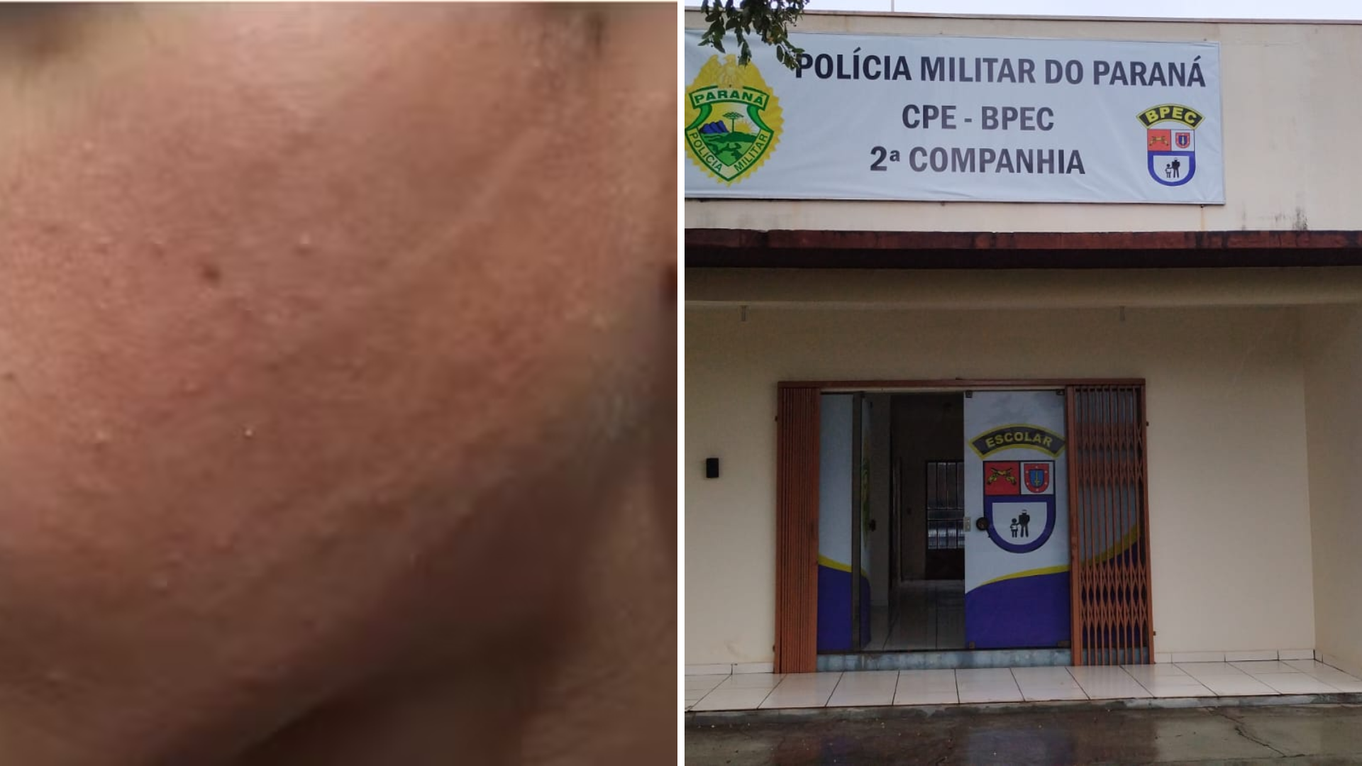Mãe diz que filho de 13 anos foi agredido dentro da escola por policial