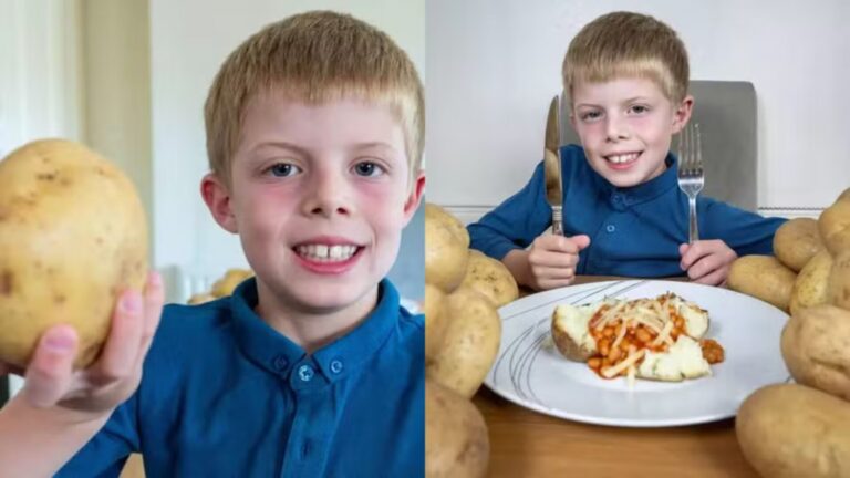 Vício! Menino que consumiu mais de 2 mil batatas precisou ser tratado com hipnose