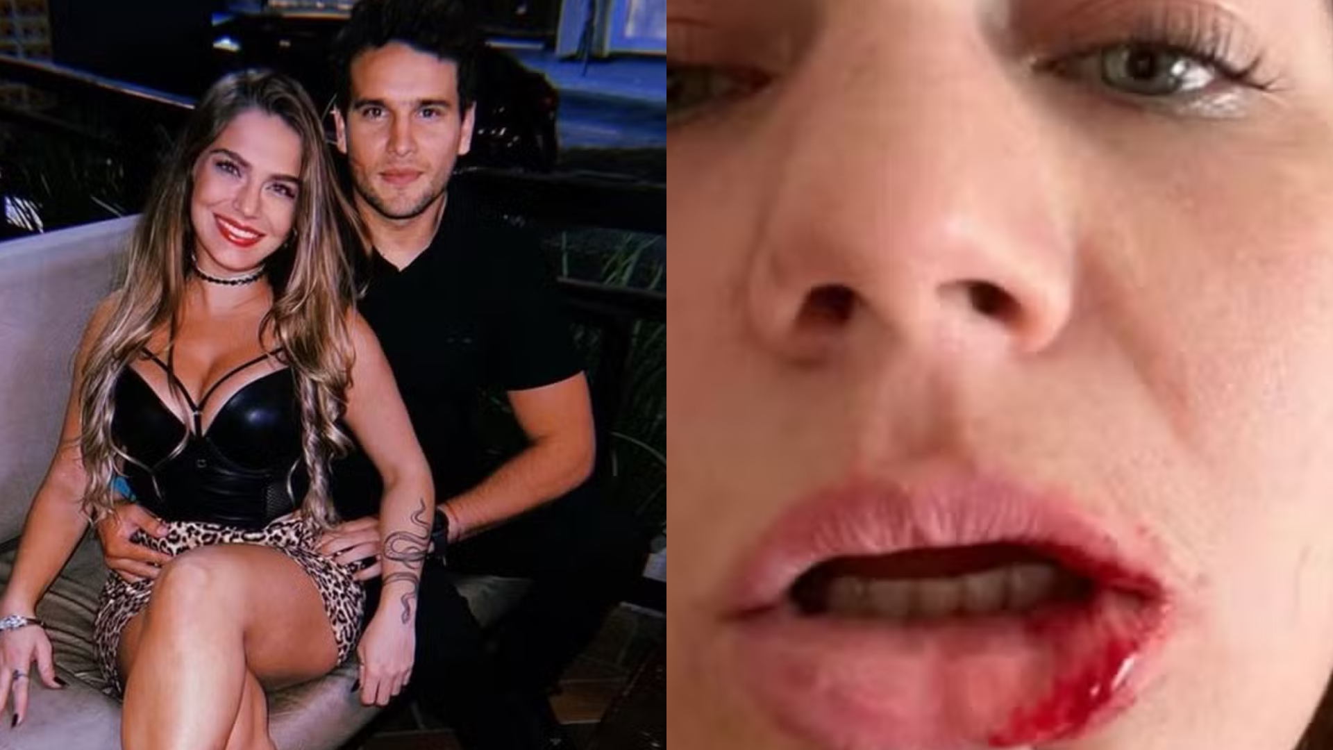 Modelo brasileira denuncia jogador por agressão e cárcere privado