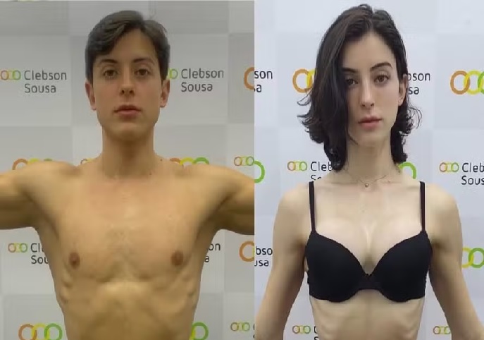 Famosa celebra resultados da transição de gênero e inspira seguidores