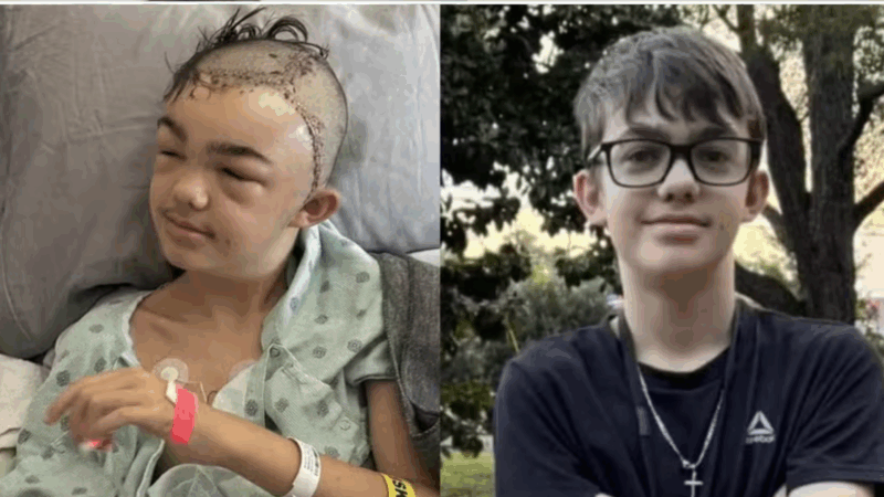 BRUTAL! Após fazer piada, garoto de 14 anos é espancado na escola e perde parte do crânio