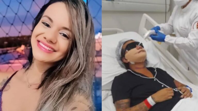 Após ser agredida com 61 socos, mulher mostra o rosto 1 mês depois da cirurgia: ‘Minha identidade’