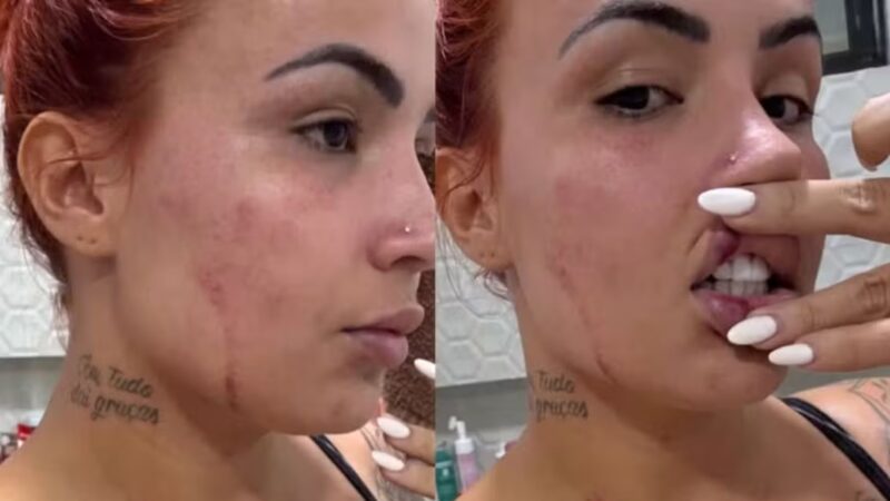 Influenciadora leva tiro de ex-marido durante perseguição em João Pessoa